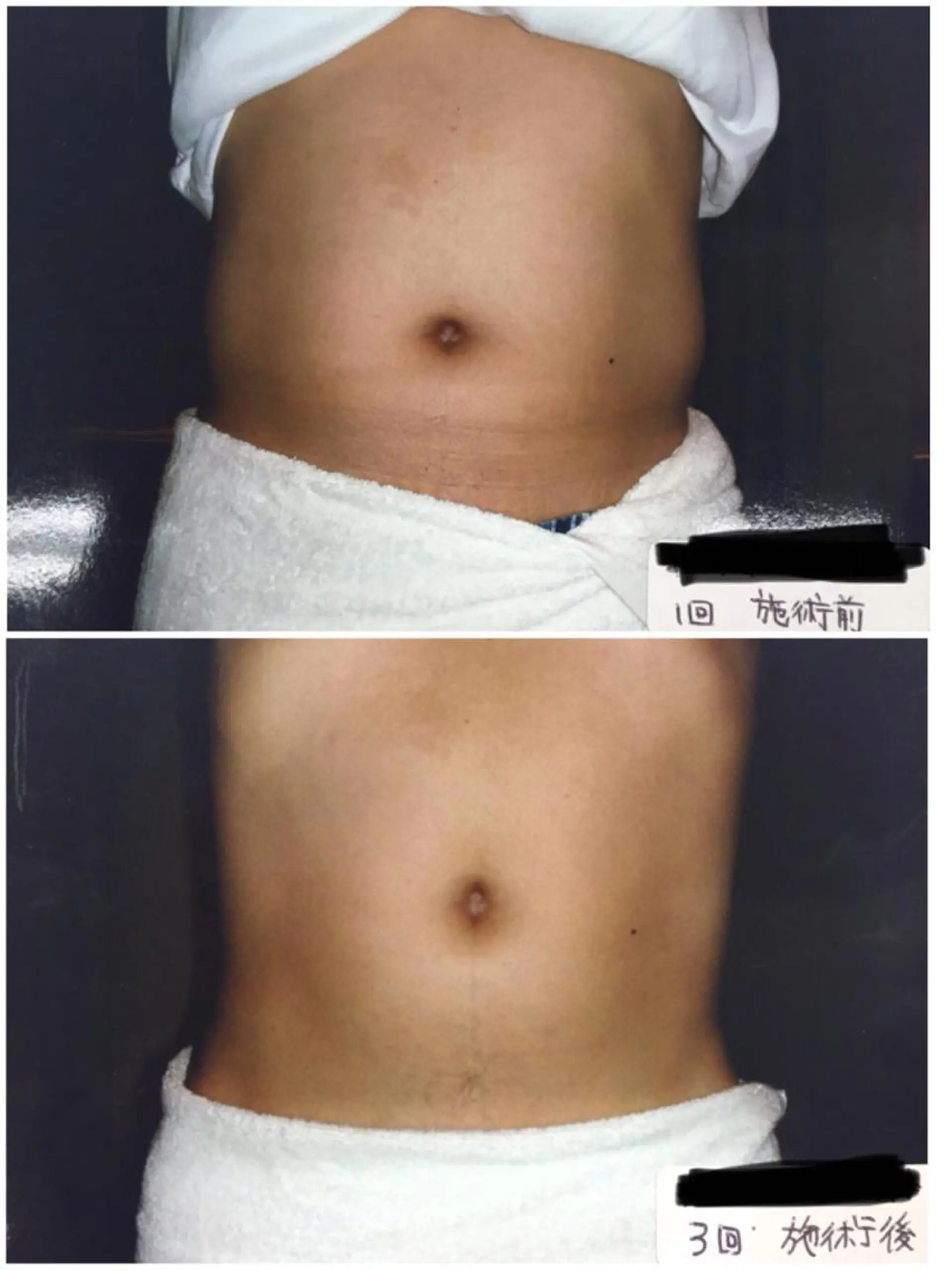 Beauty Salon Mirei所属・Beauty SalonMireiのエステ・リラクイメージ