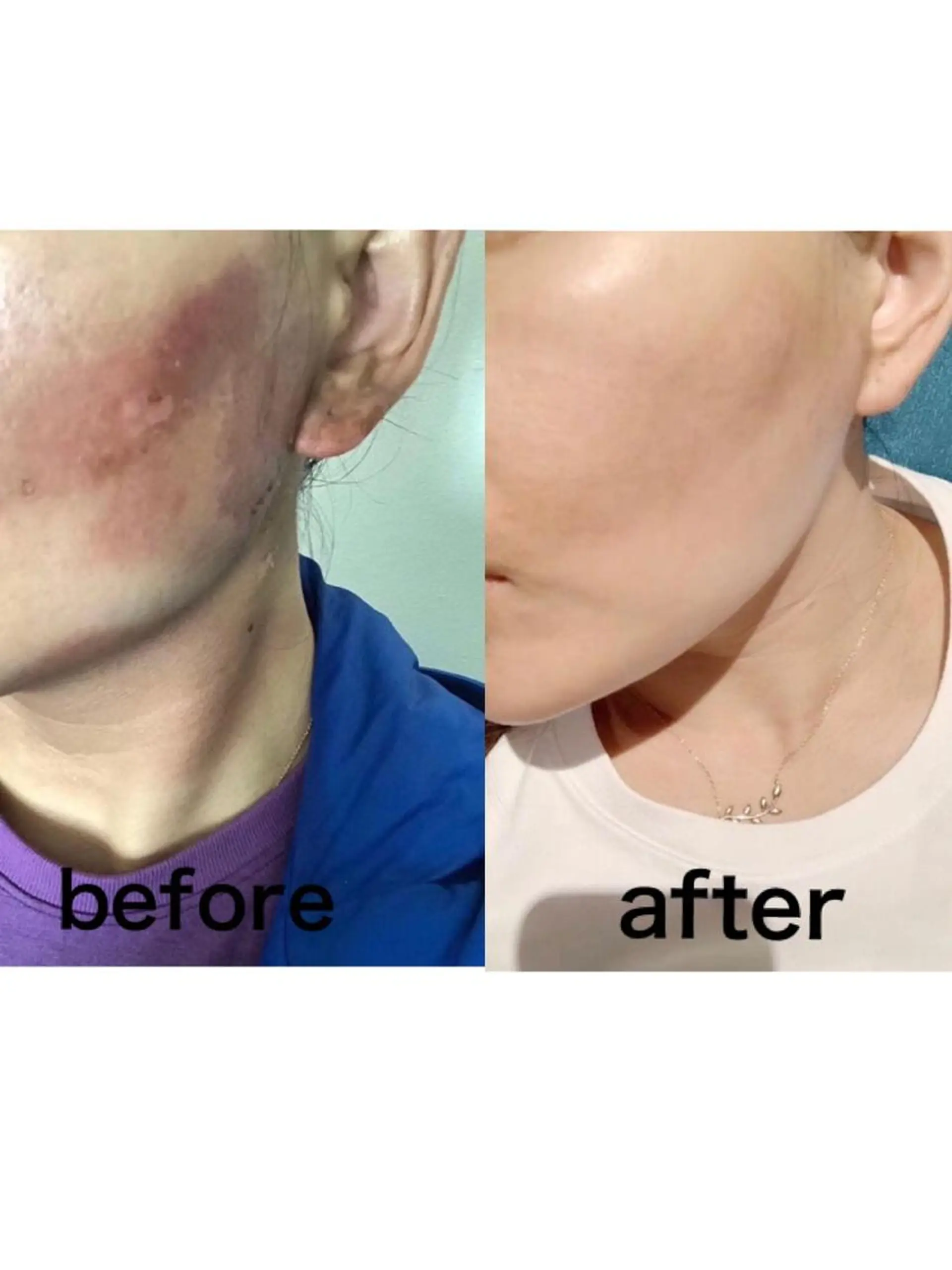 エステサロンvivi 脱毛・エステ・まつ毛のその他イメージ