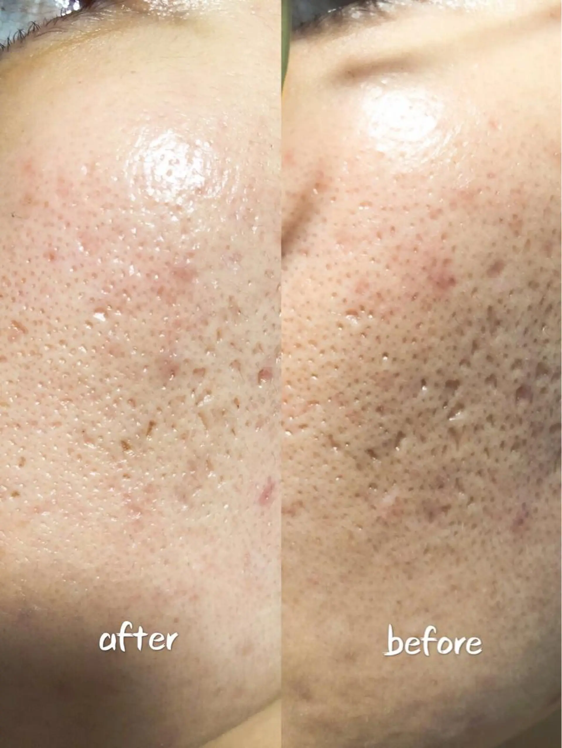 エステ A.mstic 美肌、美ボディ専門店のエステ・リラクイメージ