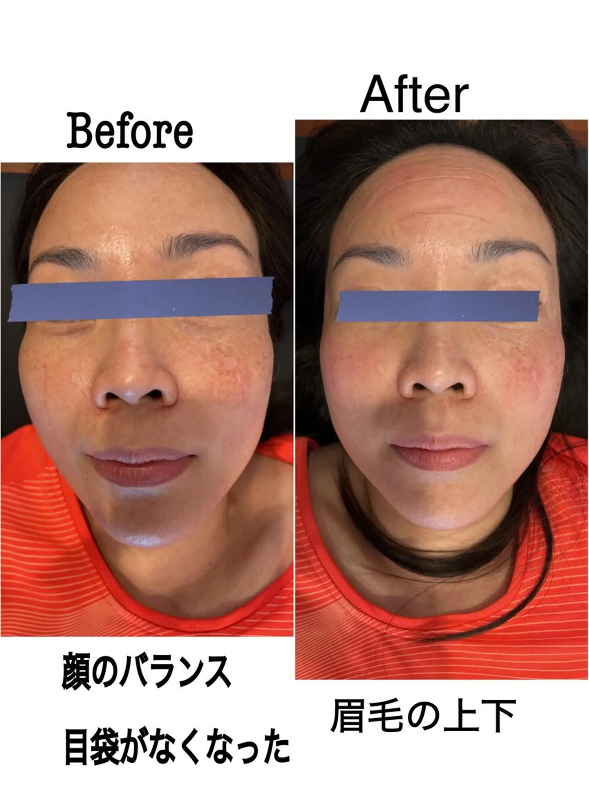 Anne’s happyBonesのエステ・リラクイメージ