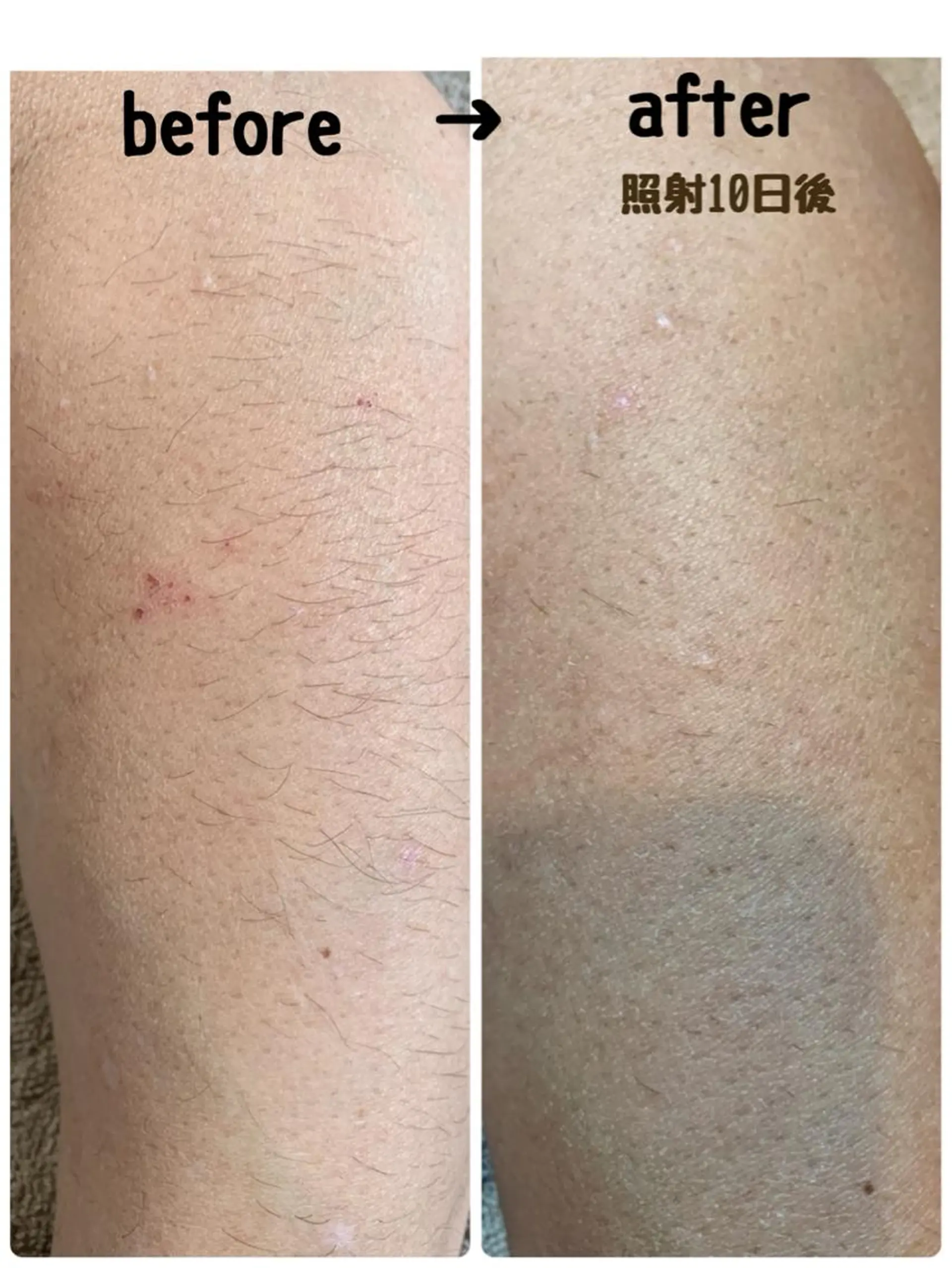 CHOUETTE所属・五島 久美子のエステ・リラクイメージ