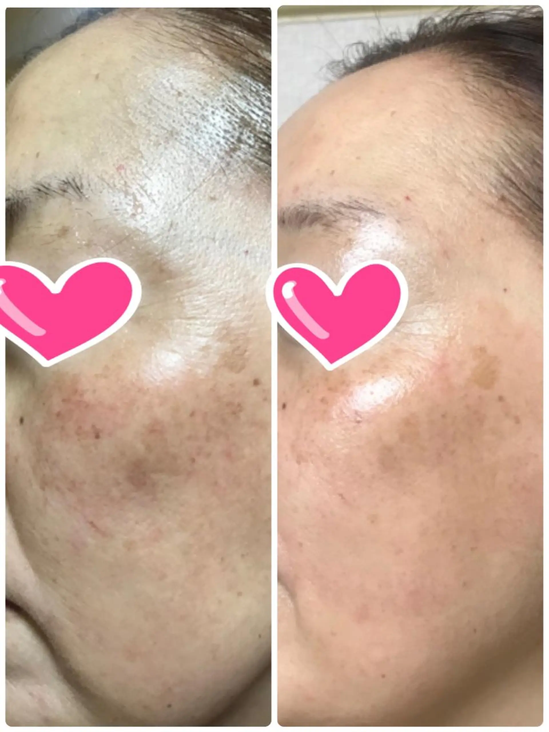 エステ メナードフェイシャルサロンメナージュ所属・メナードフェイシャル サロンメナージュのエステ・リラクイメージ