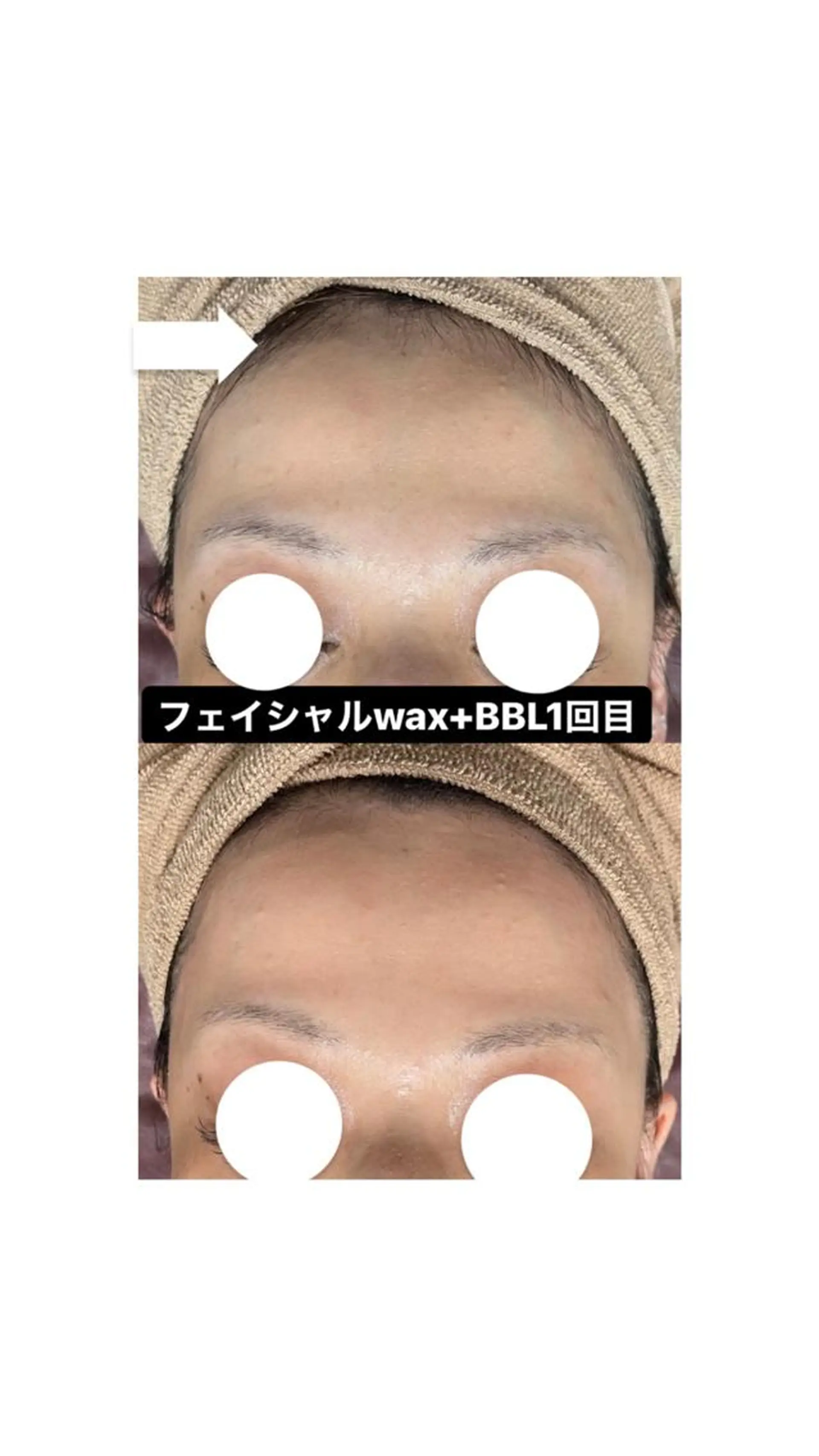 Epina 千葉店 【エピナ】のエステ・リラクイメージ