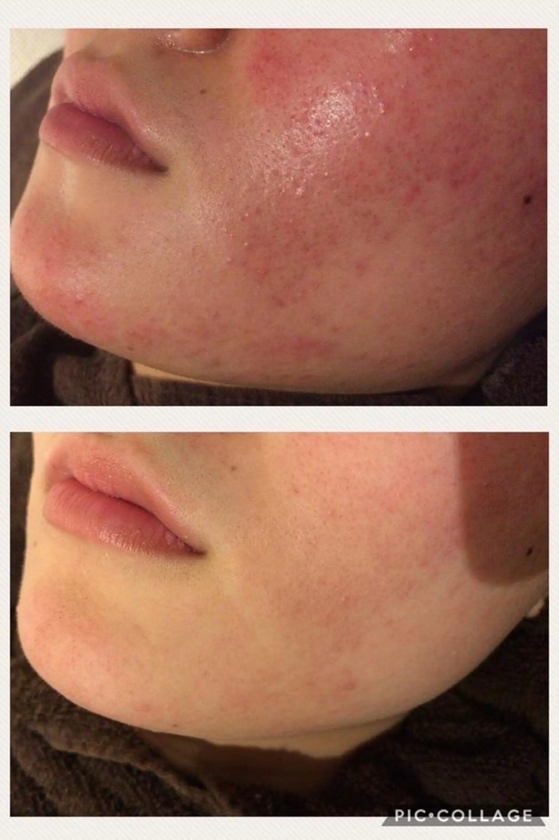 セミロング カラー パーマ ヘアアレンジ メンズ キッズ ネイル マツエク・マツパ アイブロウ エステ リラク ニキビ特化型エステ 🍓最短で肌質改善のエステ・リラクイメージ