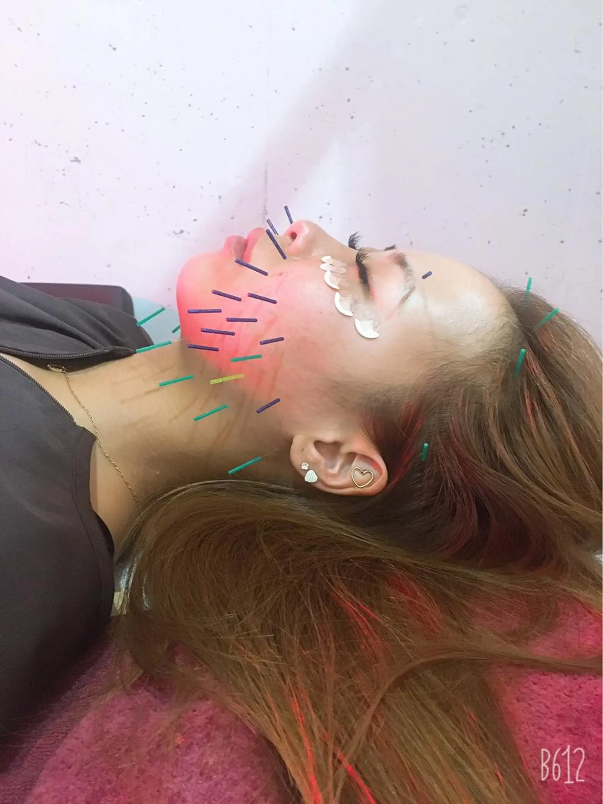 美容鍼灸女性専用 りんご鍼灸治療院のエステ・リラクイメージ