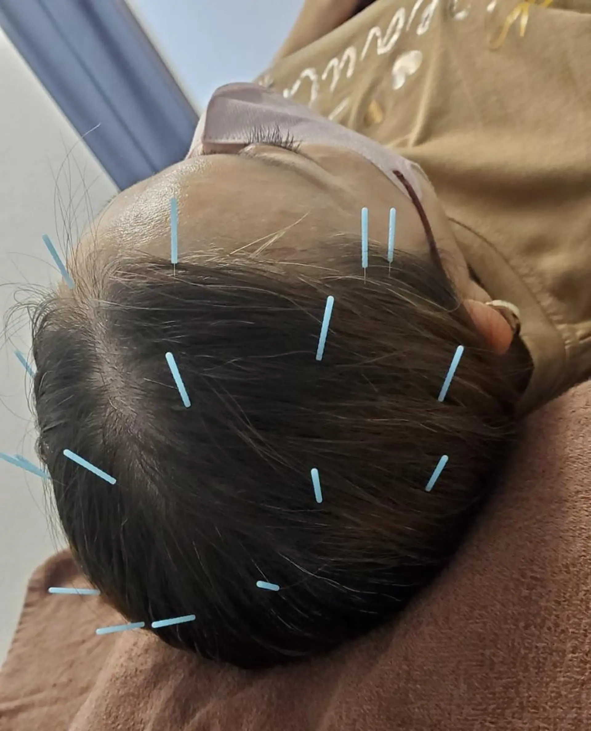 エステ リラク ベレディオ Miuraのエステ・リラクイメージ