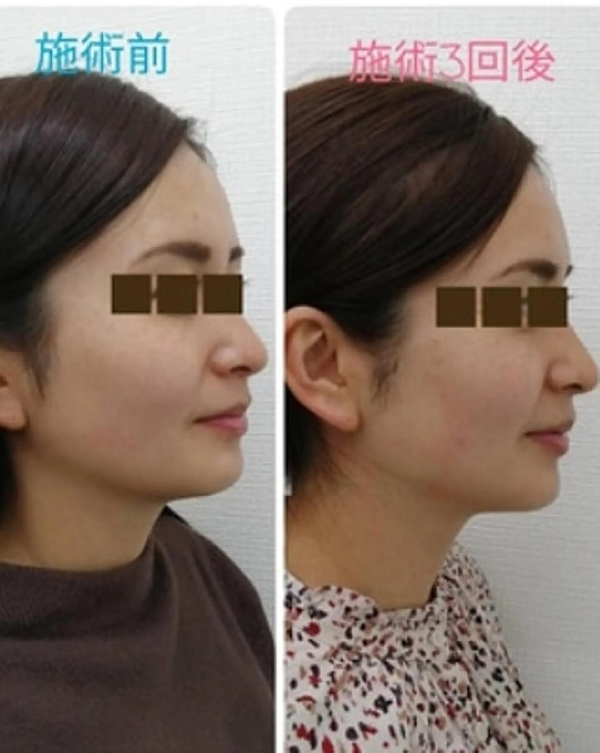 エステ リラク CORAL湘南平塚店所属・【小顔・美容専門】 🐠リカのエステ・リラクイメージ