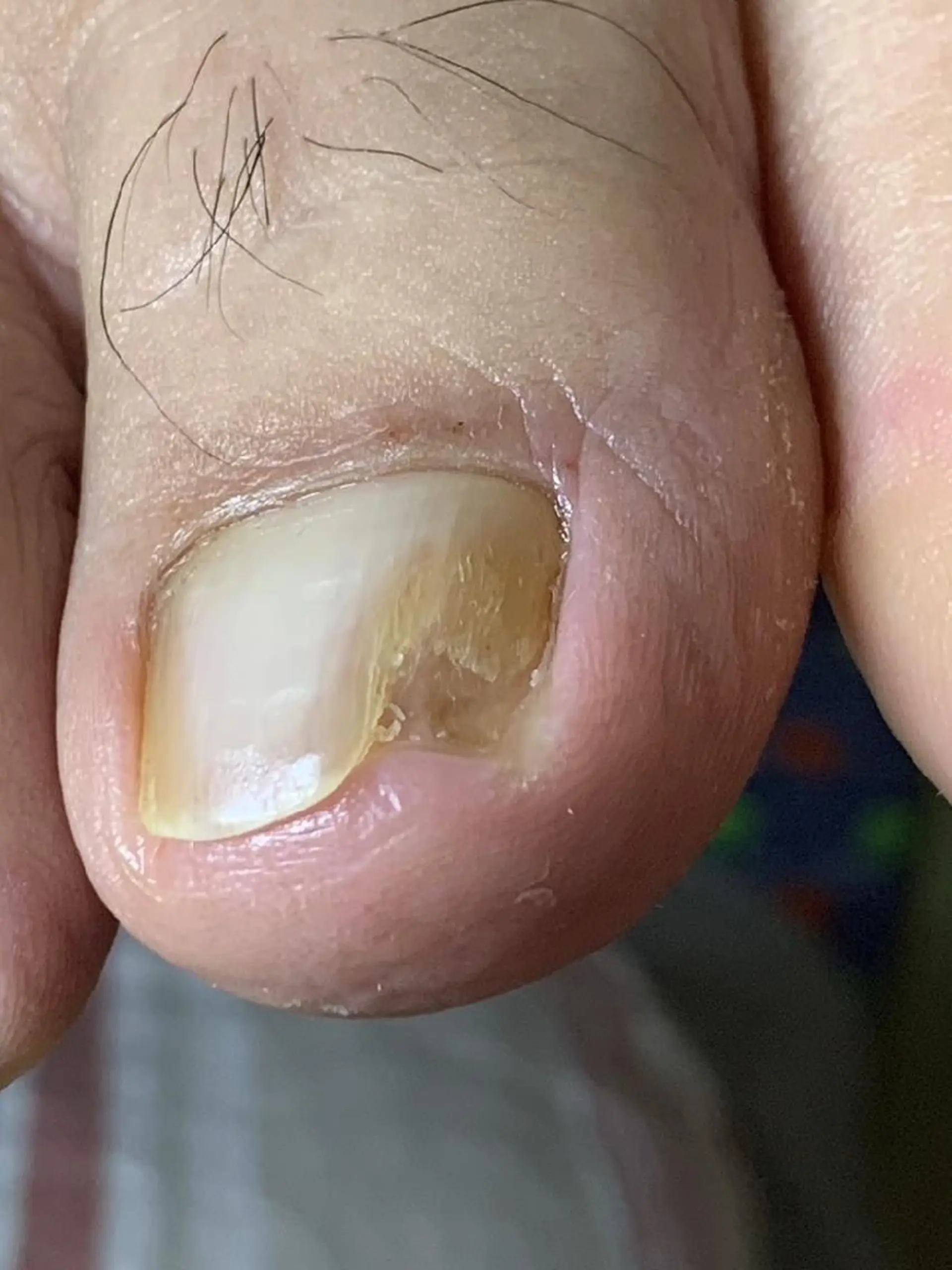 carenail　 tsugumiのその他イメージ