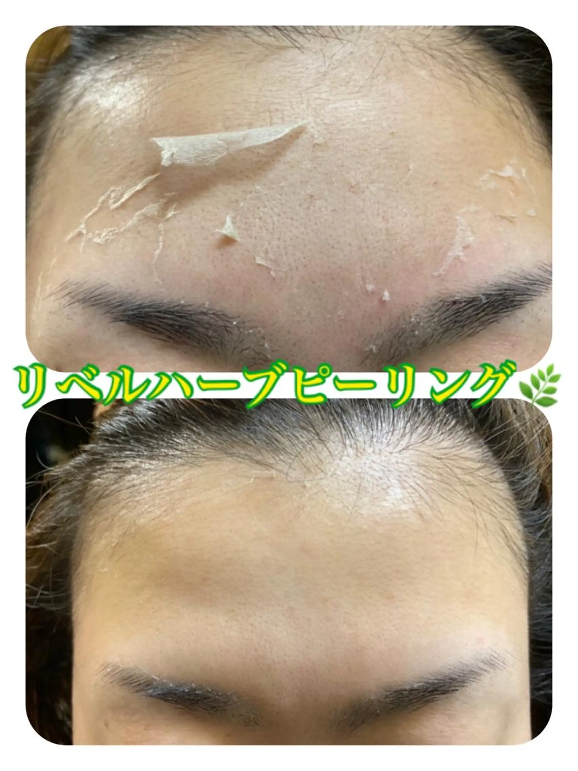 エステ 【リベルハーブピーリング認定店】敏感肌・美白脱毛専門店Dione立川店所属・Dione 立川店のエステ・リラクイメージ