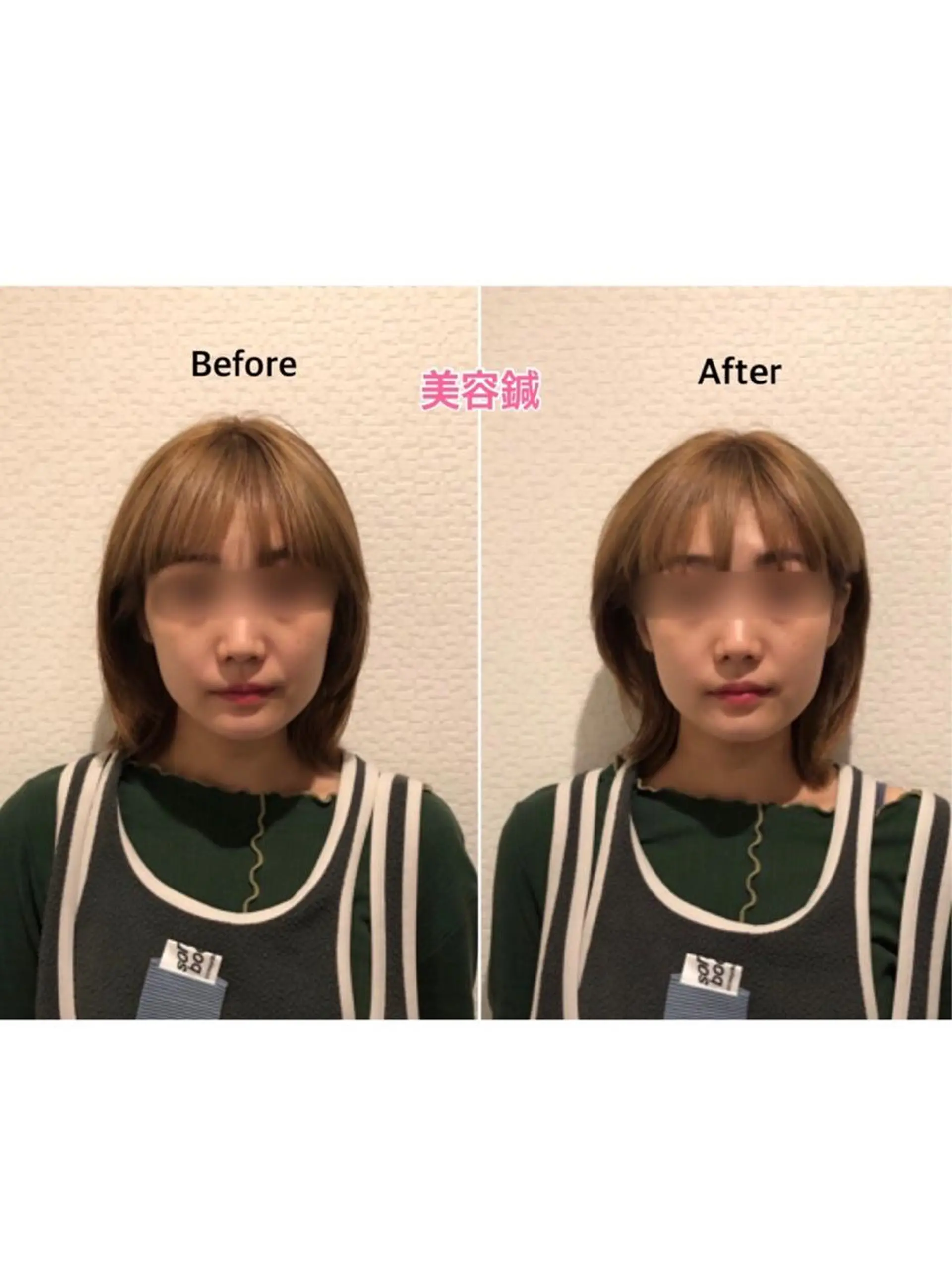 エステ チキバン美容鍼灸整体 サロン心斎橋店のエステ・リラクイメージ