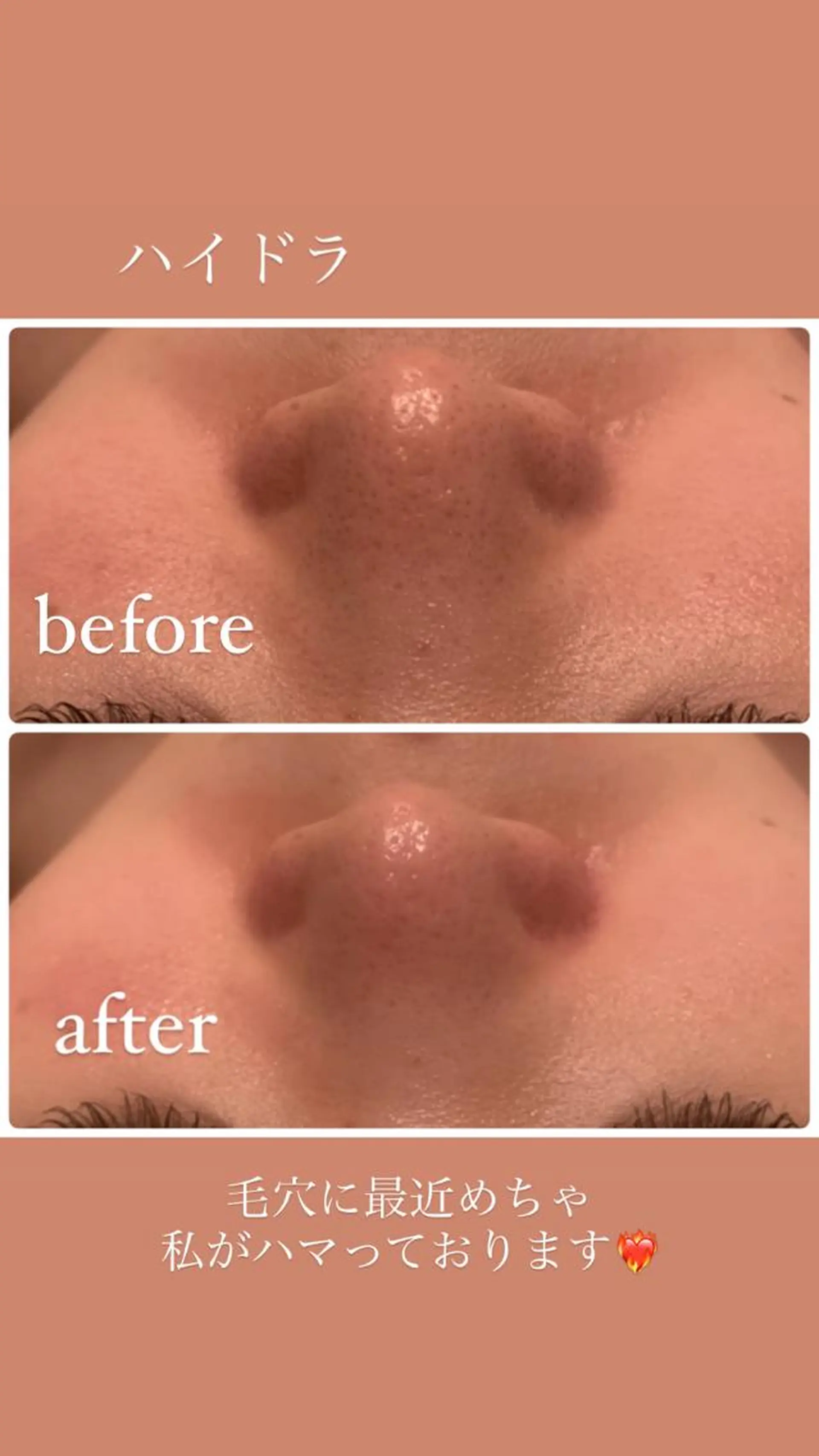 その他 種市 貴子のその他イメージ