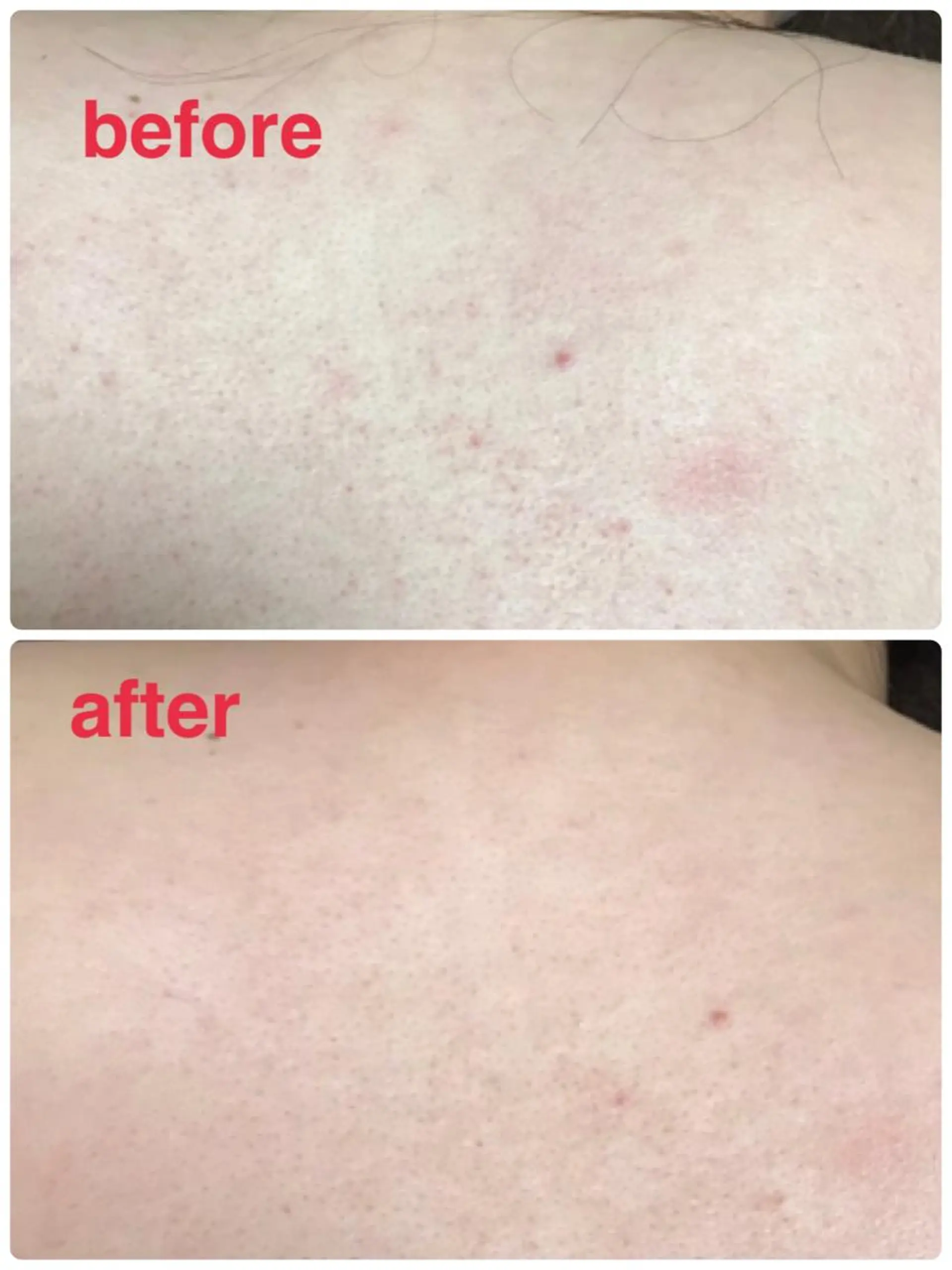 首・肩こり専門リンパ ケアサロンSENKAのエステ・リラクイメージ