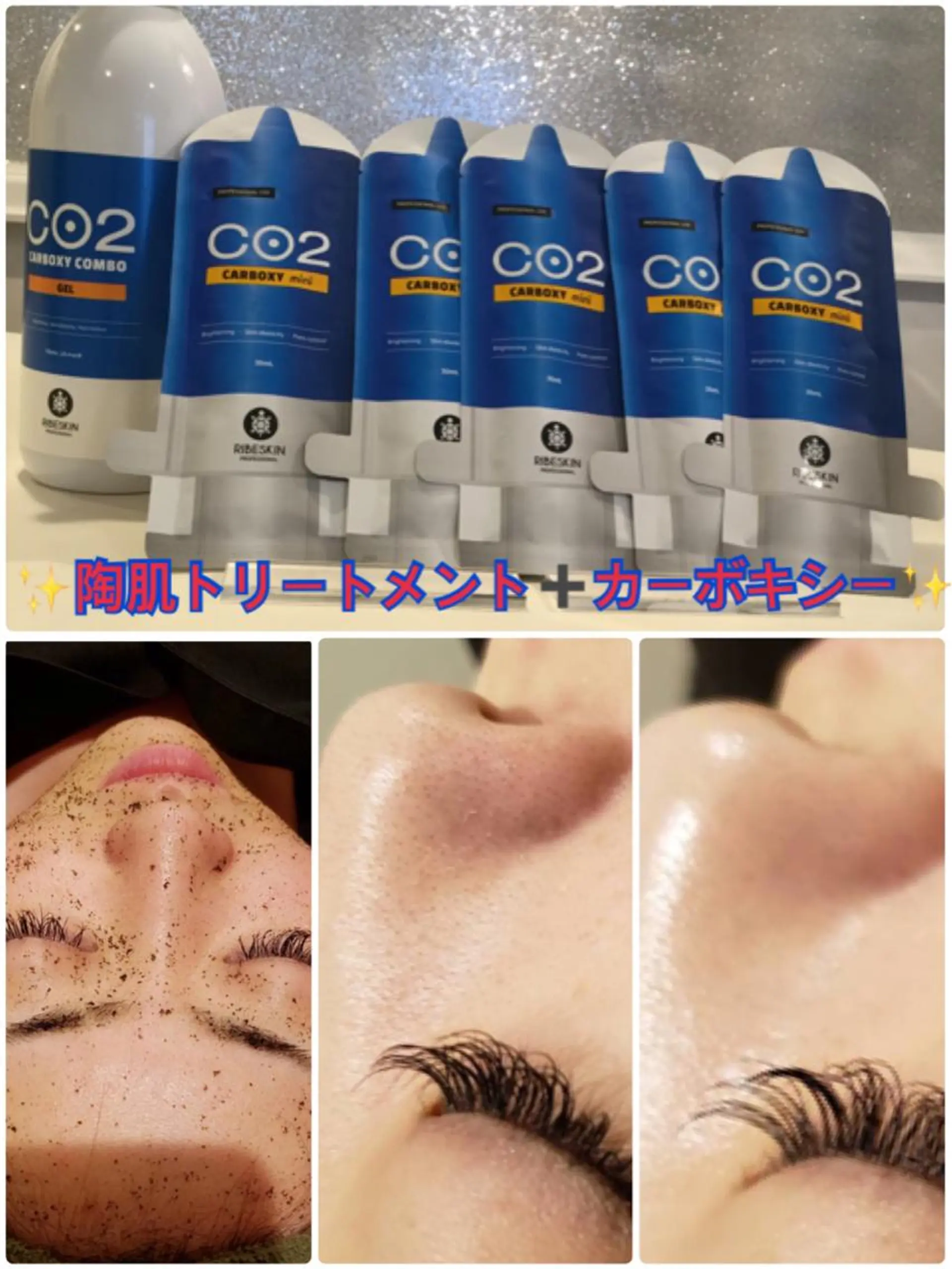 【リベルハーブピーリング認定店】敏感肌・美白脱毛専門店Dione立川店所属・Dione 立川店のエステ・リラクイメージ