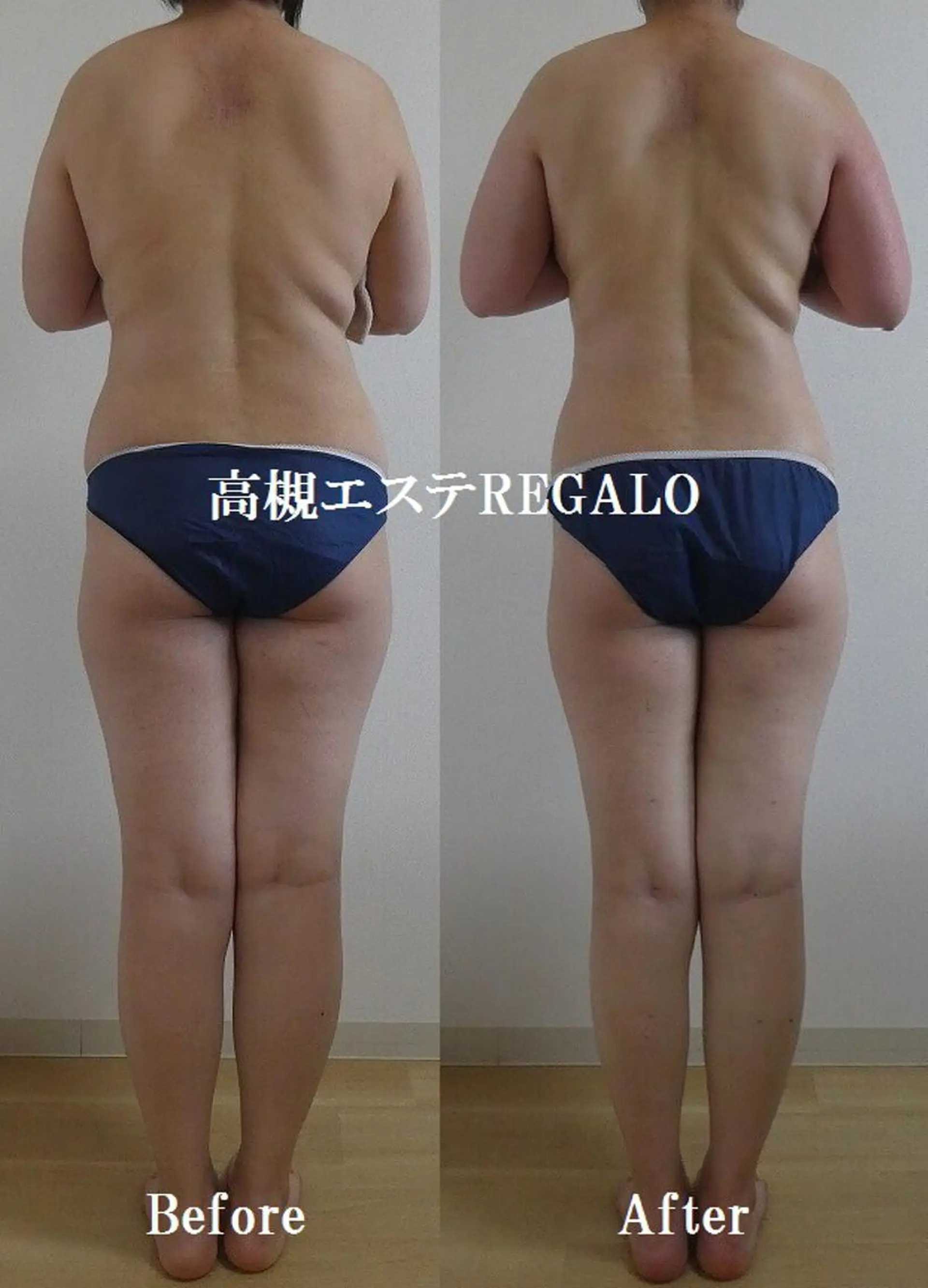 エステ リラク REGALO所属・矢野 さやかのエステ・リラクイメージ