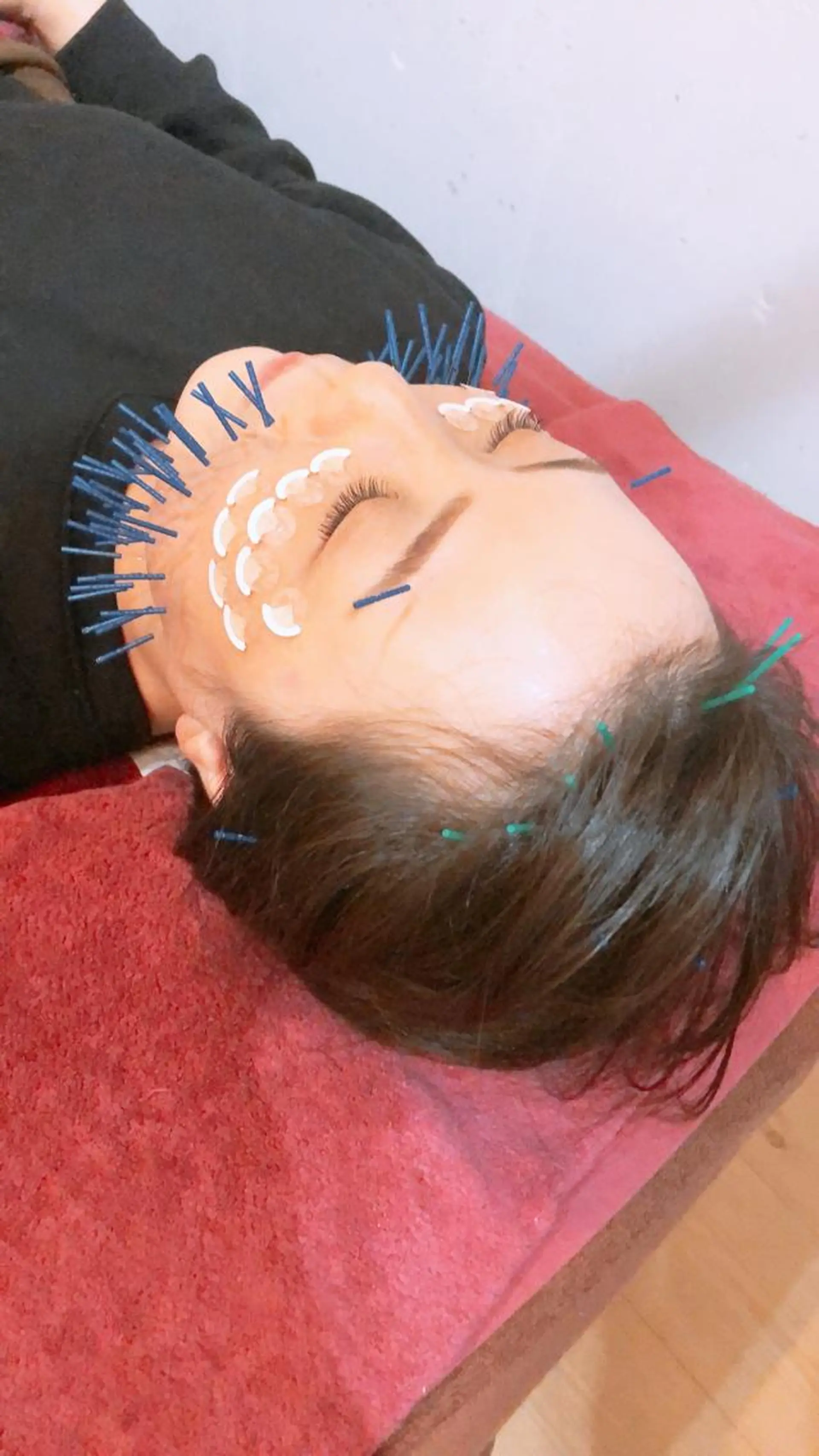 エステ リラク 美容鍼灸女性専用 りんご鍼灸治療院のエステ・リラクイメージ