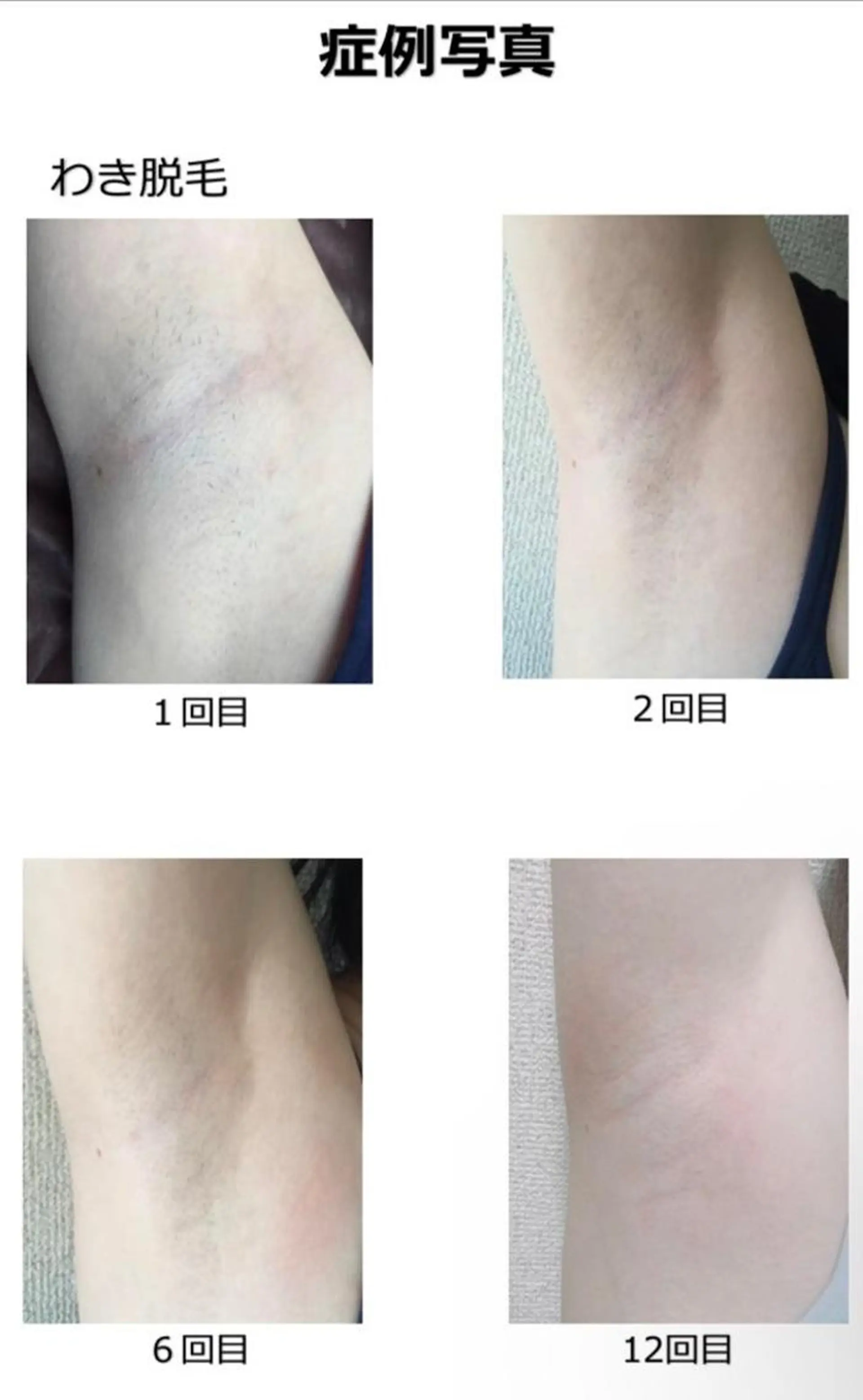 脱毛サロンPetit ange所属・Petit ange 綾瀬のエステ・リラクイメージ