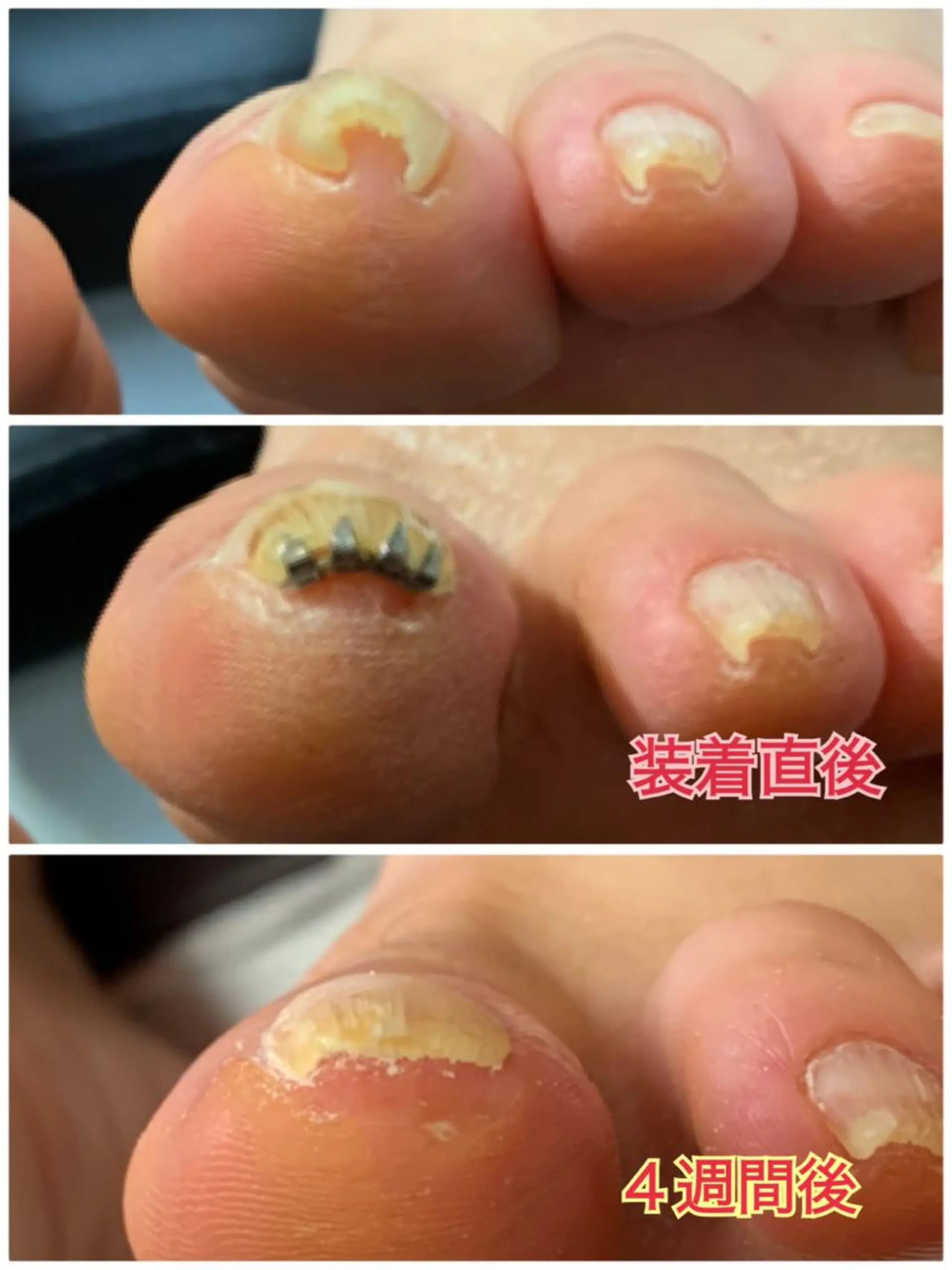 ネイル HANA │ネイルのネイルデザイン