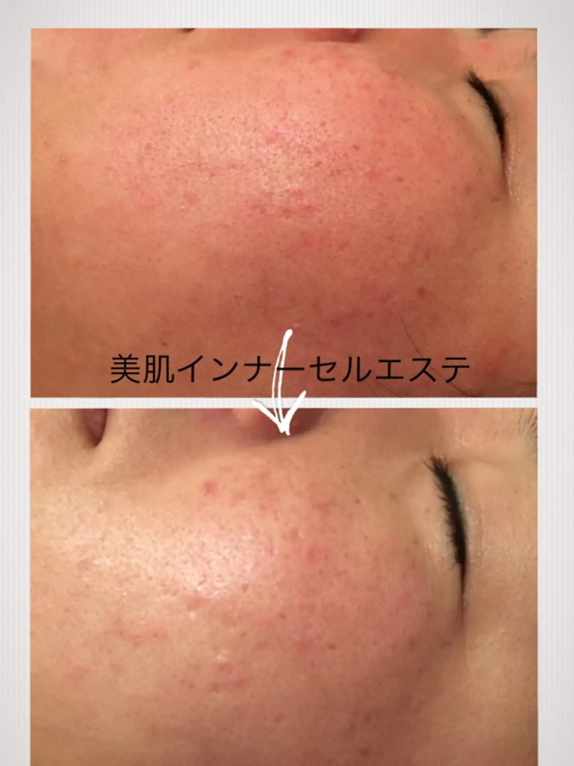 美筋骨格リンパ®️ Aroleのエステ・リラクイメージ