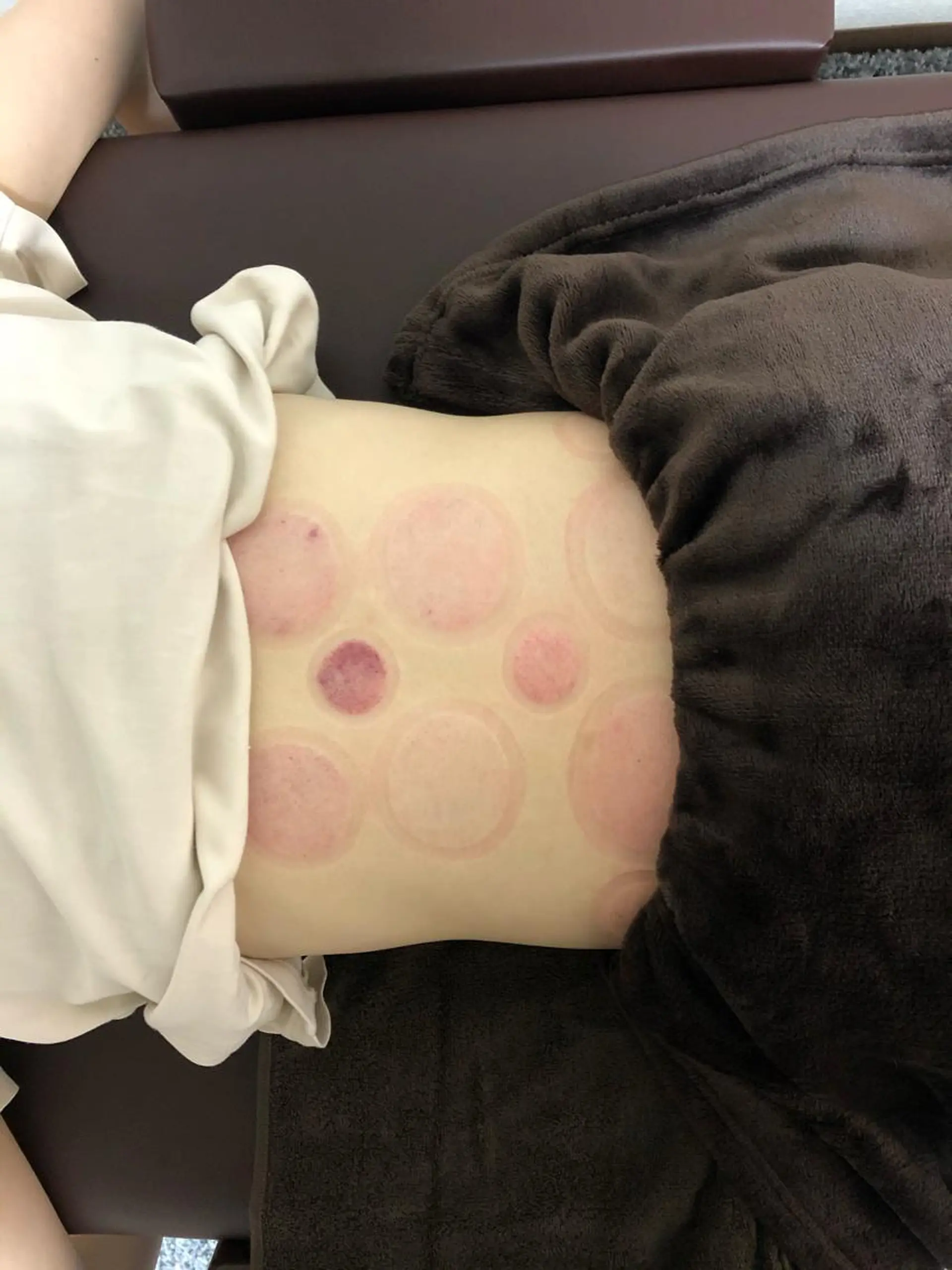 エステ リラク やはた鍼灸整骨院所属・やはた 鍼灸整骨院のエステ・リラクイメージ