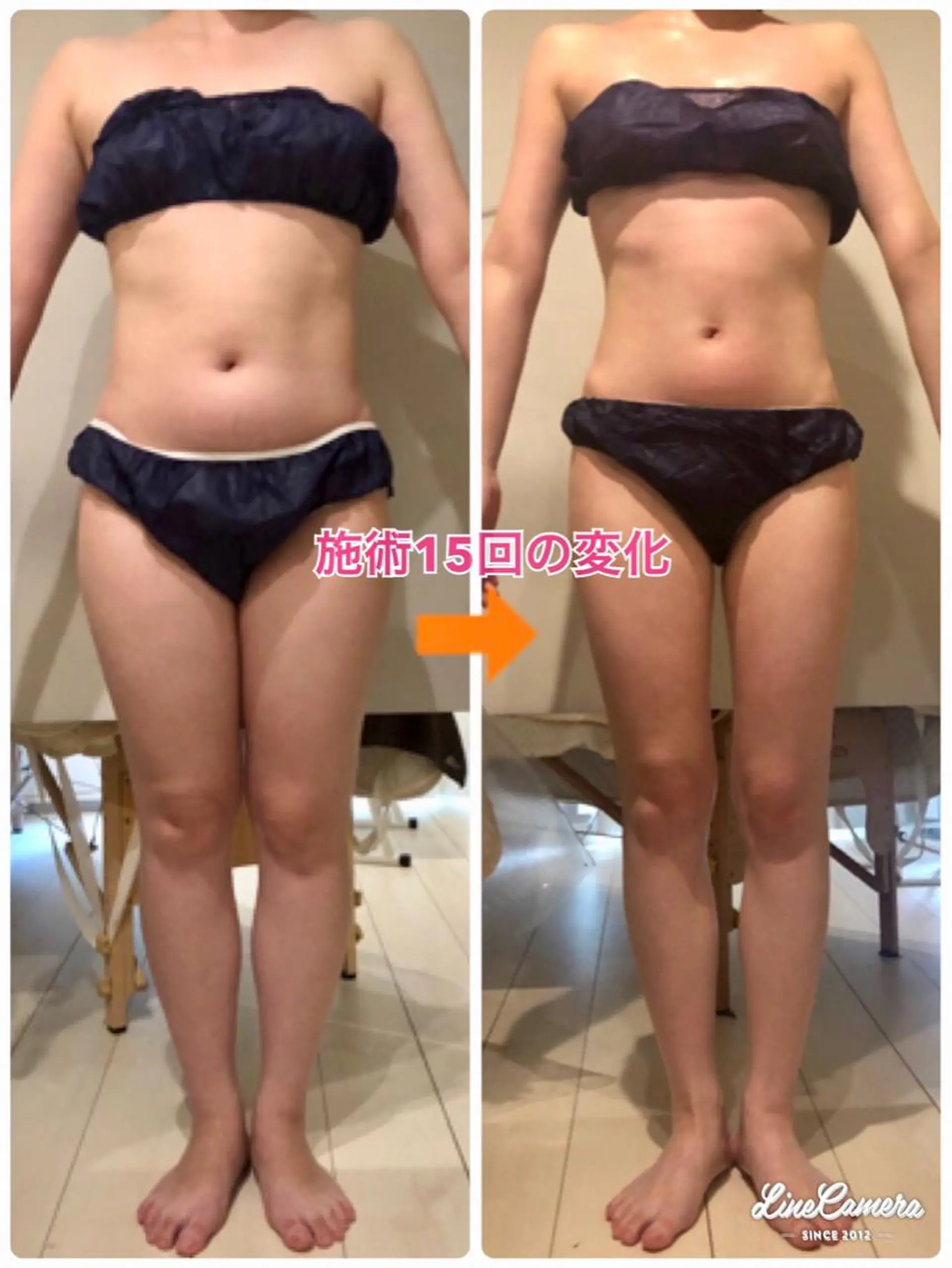 ショート カラー パーマ ヘアアレンジ メンズ キッズ ネイル マツエク・マツパ ‍痩身＆ボディ 結果出し🌟丹野のエステ・リラクイメージ