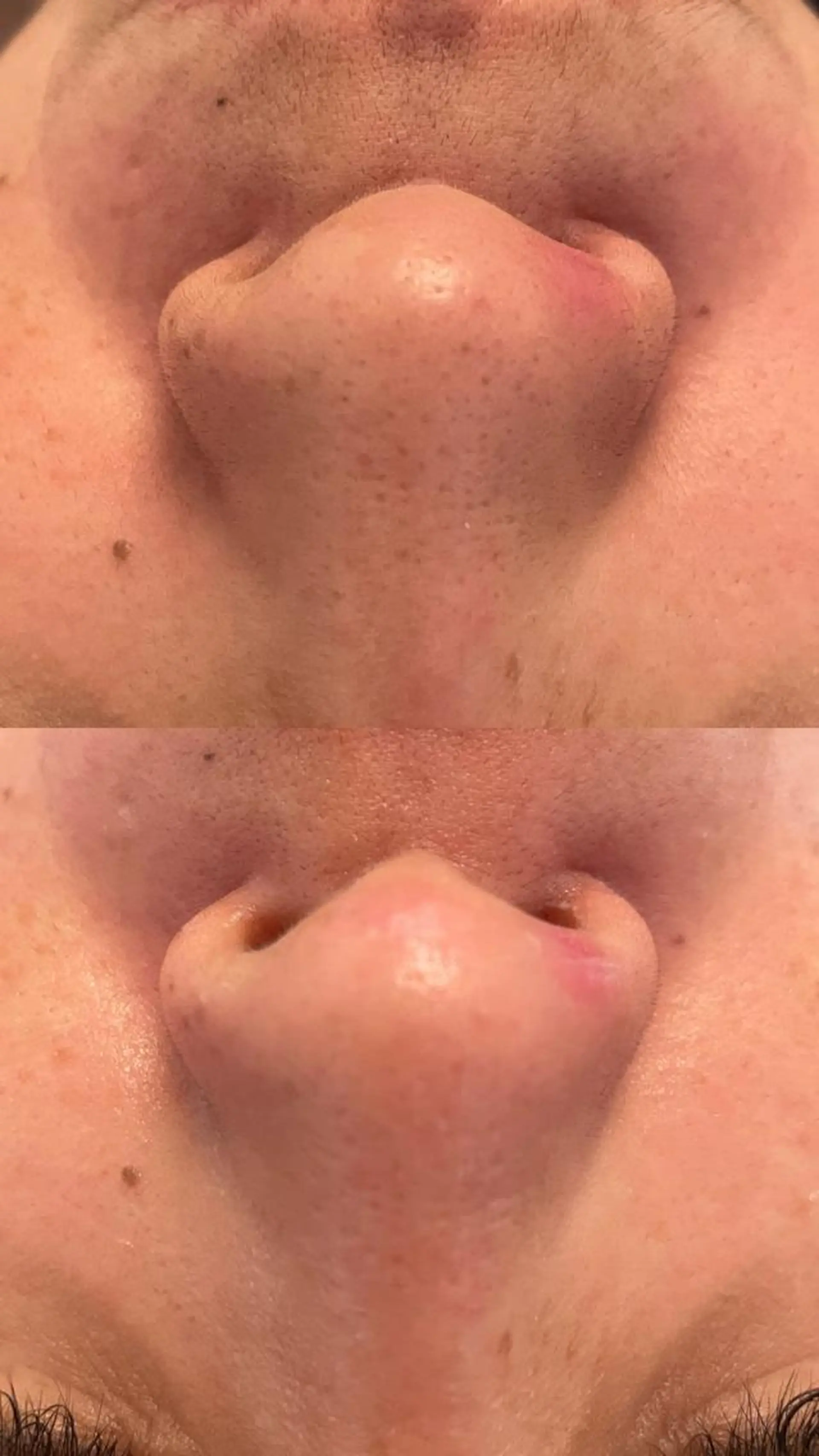 amu nail. RINAのネイルデザイン