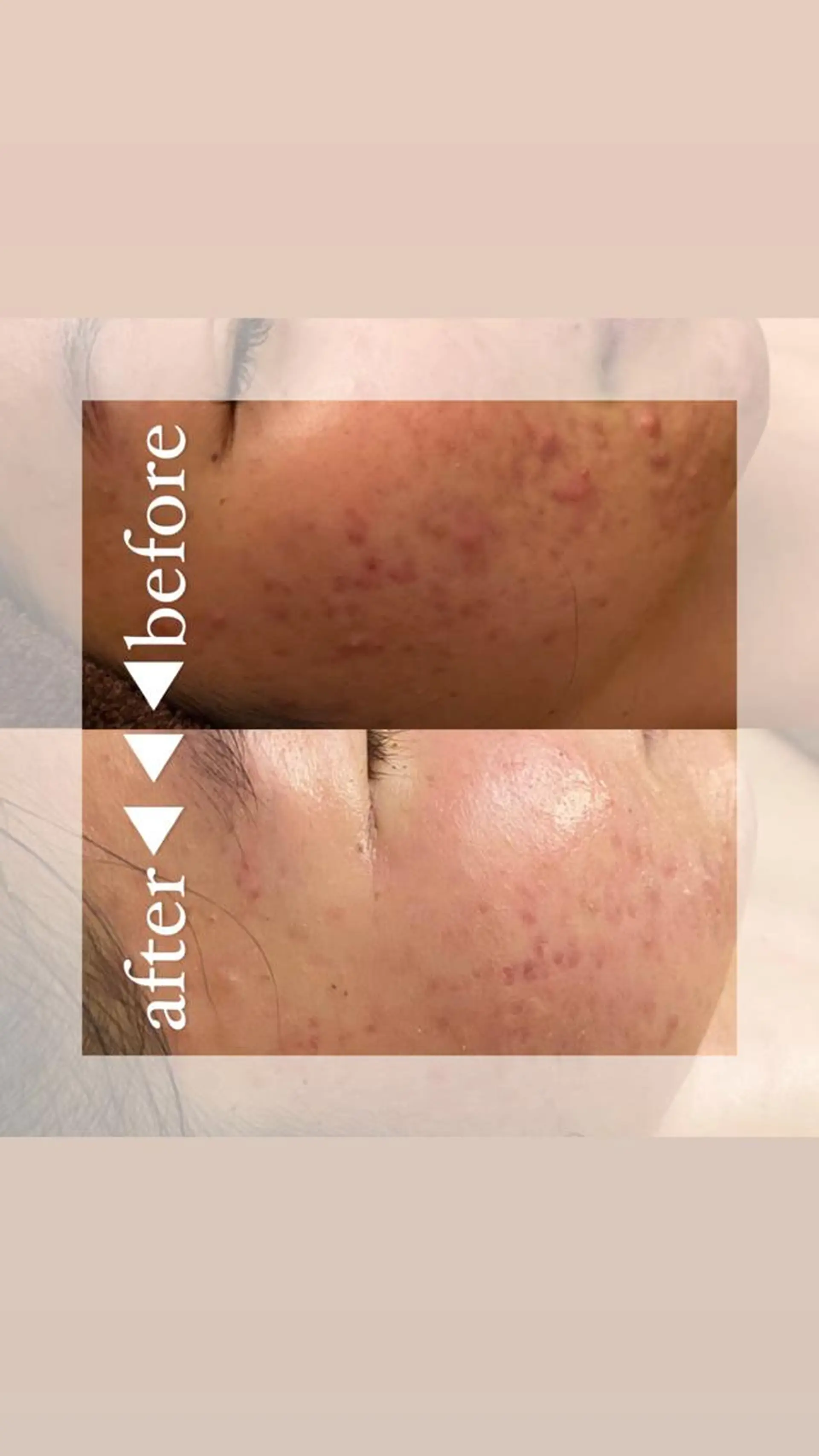 hm NATURESKINのエステ・リラクイメージ