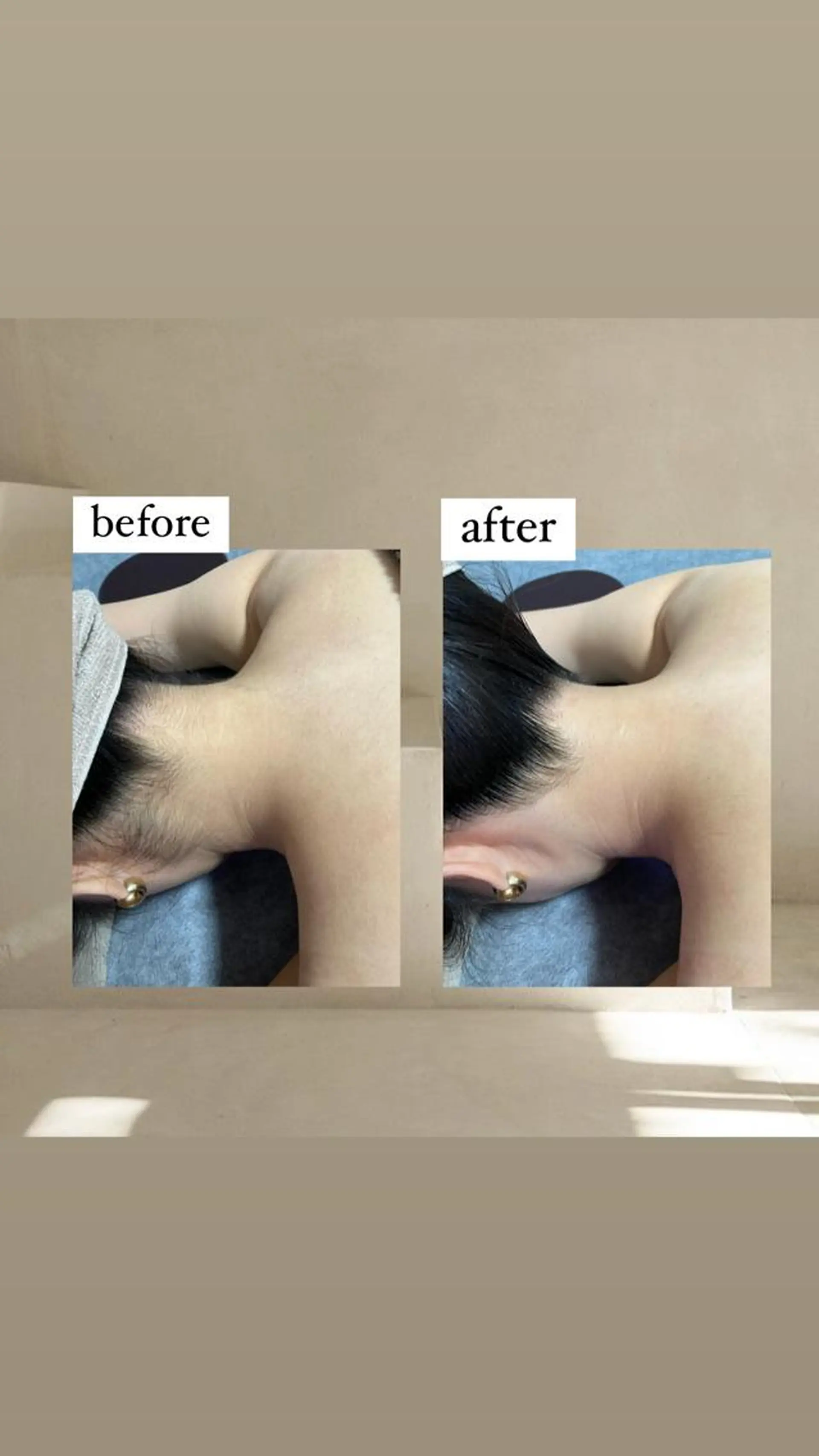 脱毛 crescent所属・【韓国肌管理・脱毛】 クレセントのその他イメージ