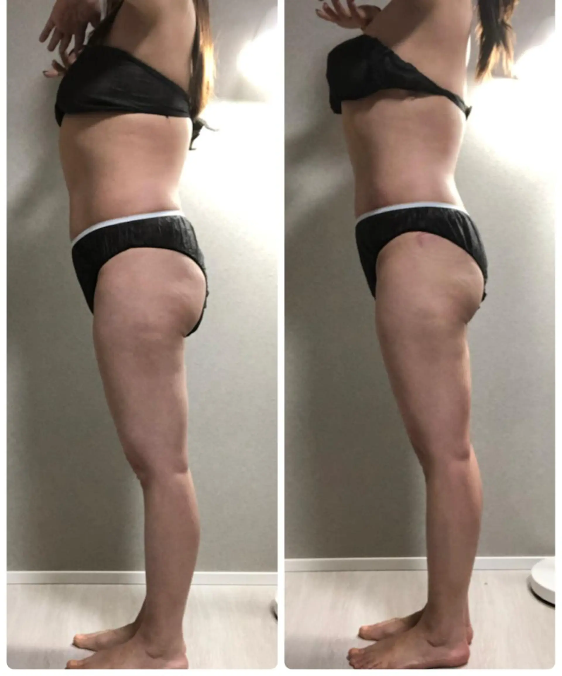 エステ エステ／ネイル/脱毛 R.Msalonのネイルデザイン