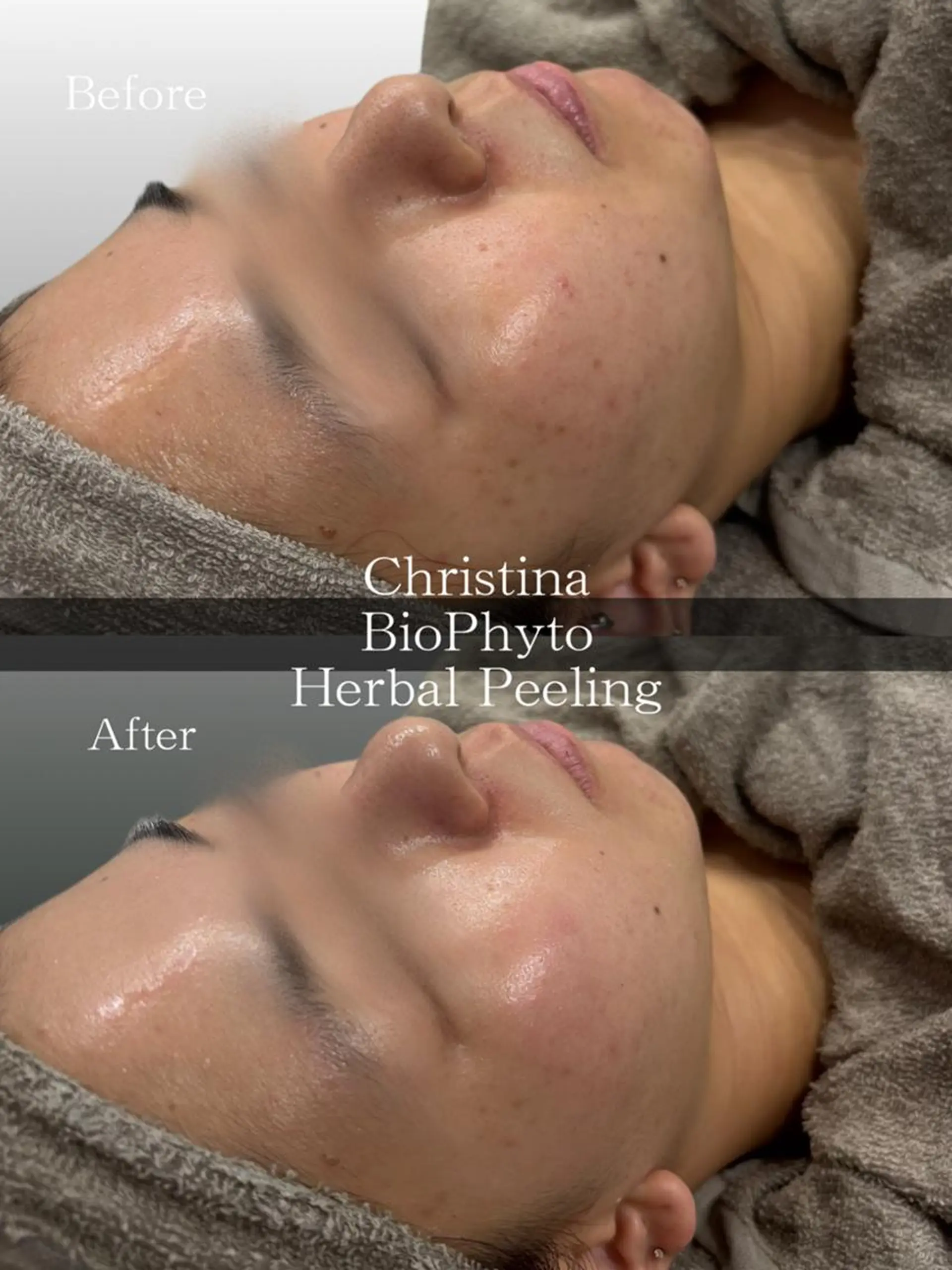 心斎橋🤍堀江.小顔 ハーブ.痩身クレビアのエステ・リラクイメージ