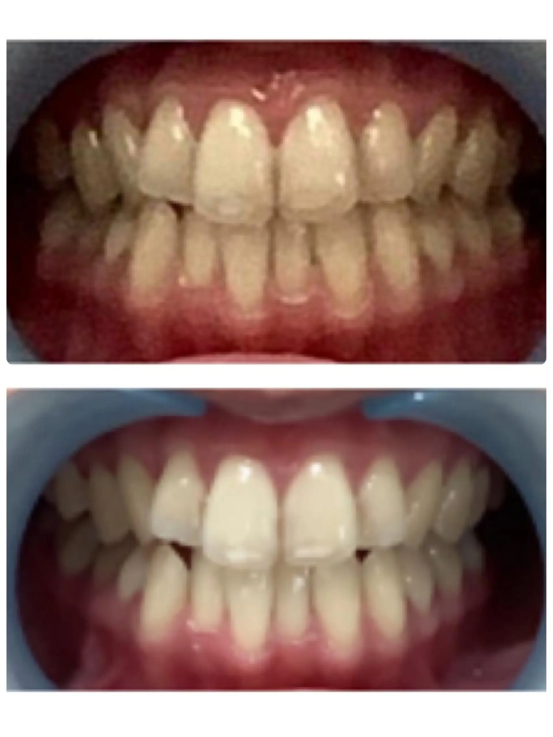 脱毛&フェイシャル BiSTA〈ビスタ〉のエステ・リラクイメージ