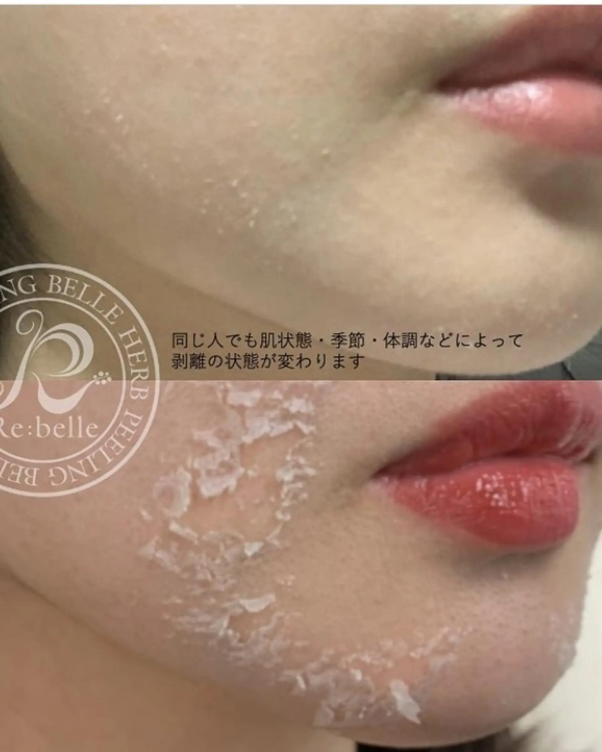 エステ Belsia千歳烏山 ピーリング＆眉毛のエステ・リラクイメージ