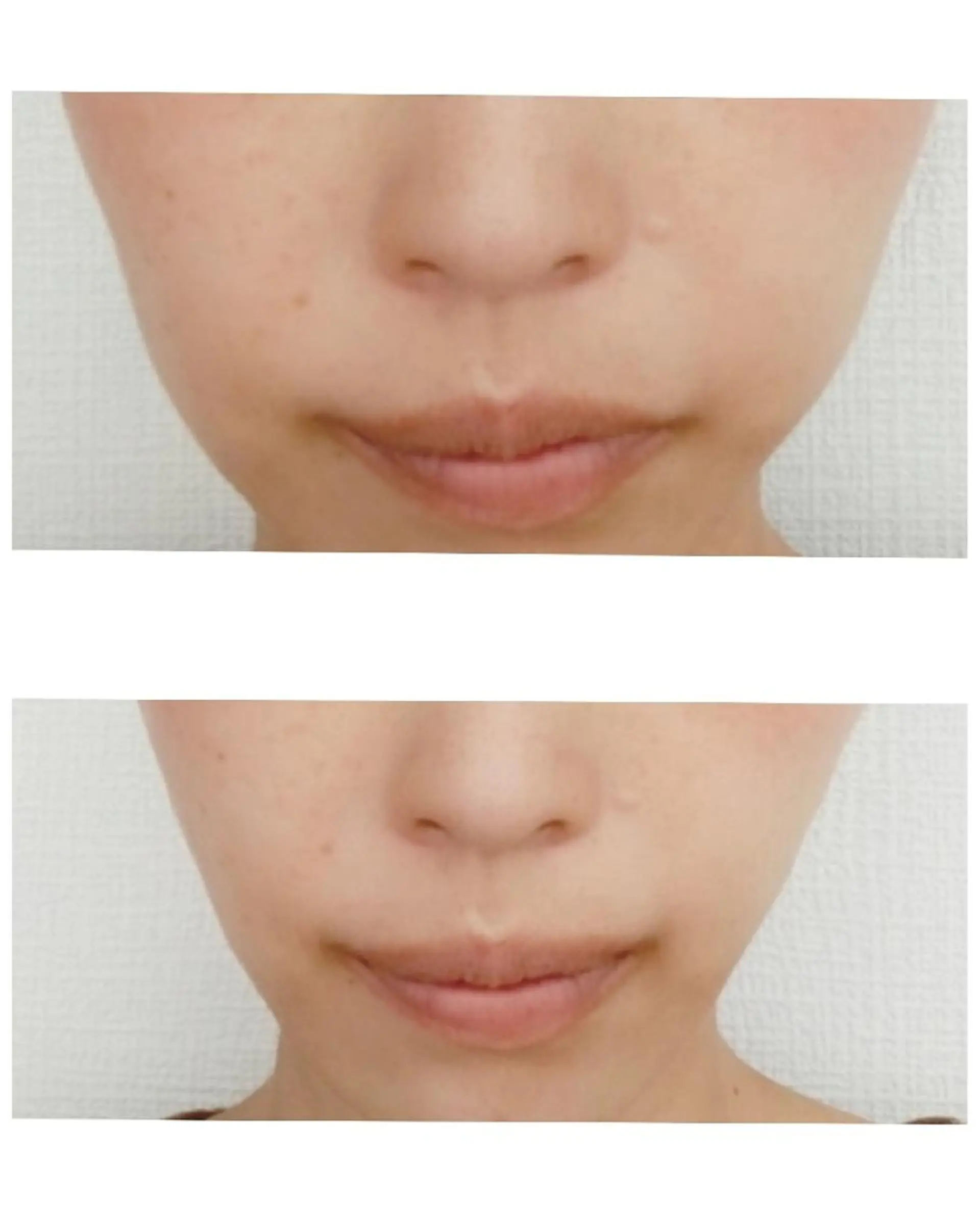 エステ リラク CORAL湘南平塚店所属・【小顔・美容専門】 🐠リカのエステ・リラクイメージ