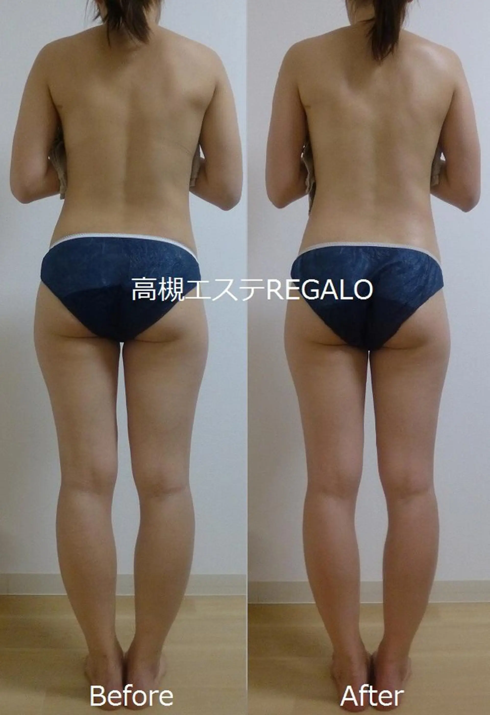 REGALO所属・矢野 さやかのエステ・リラクイメージ