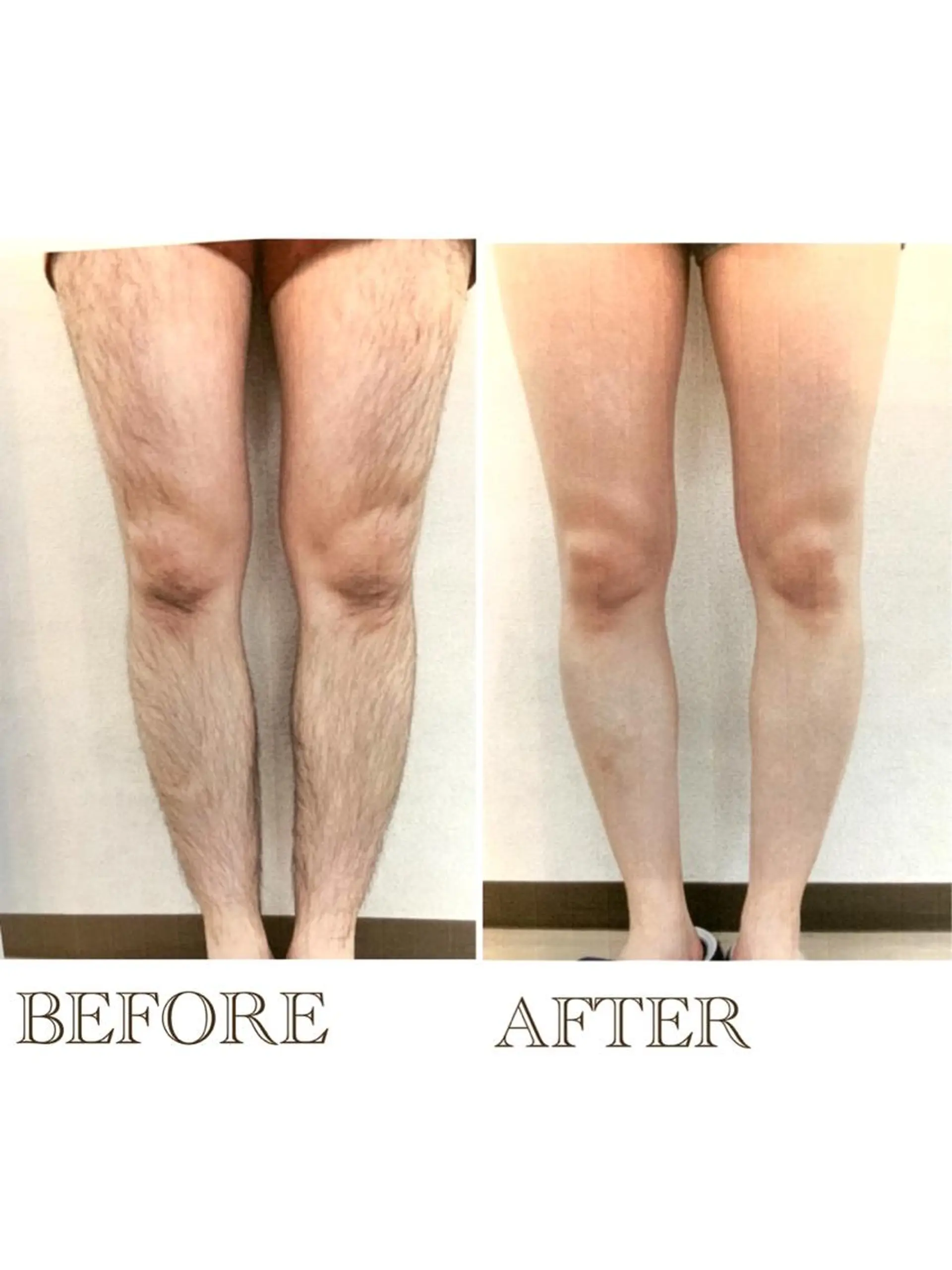 ❤️セルフ脱毛サロン jewel nailのエステ・リラクイメージ