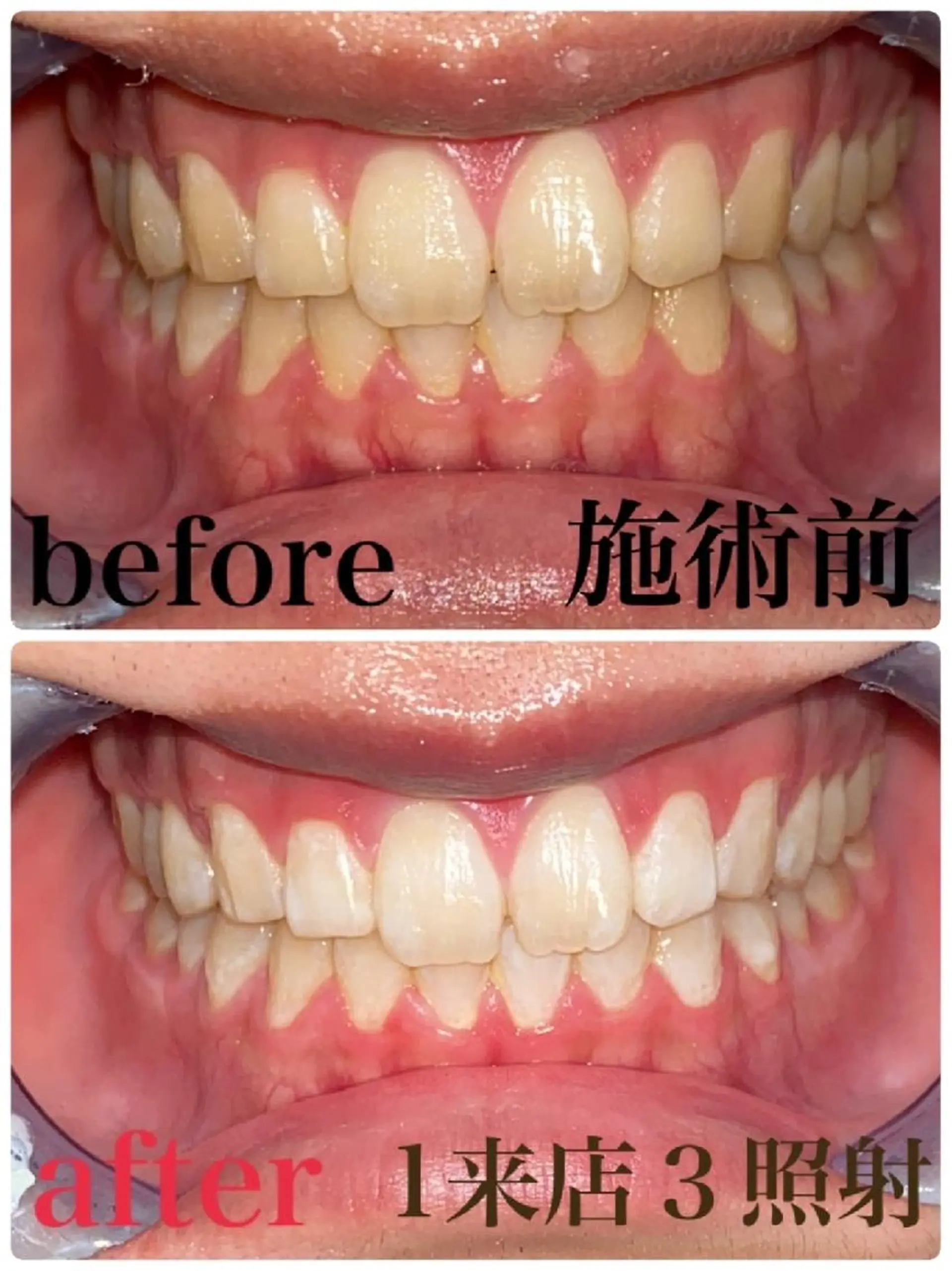 エステ リラク Rise　beauty salon所属・RISE beaut y salonのその他イメージ