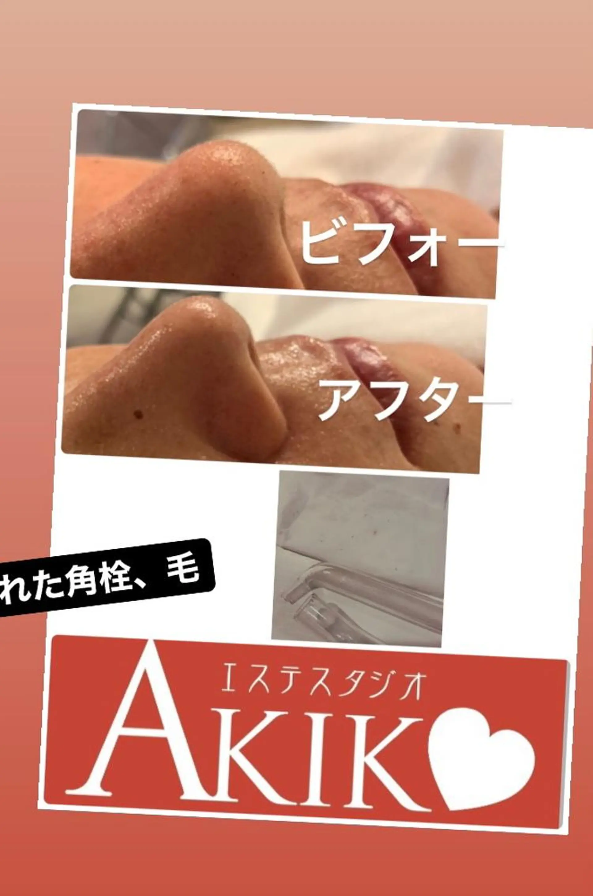 後藤 あきこのマツエク・マツパデザイン