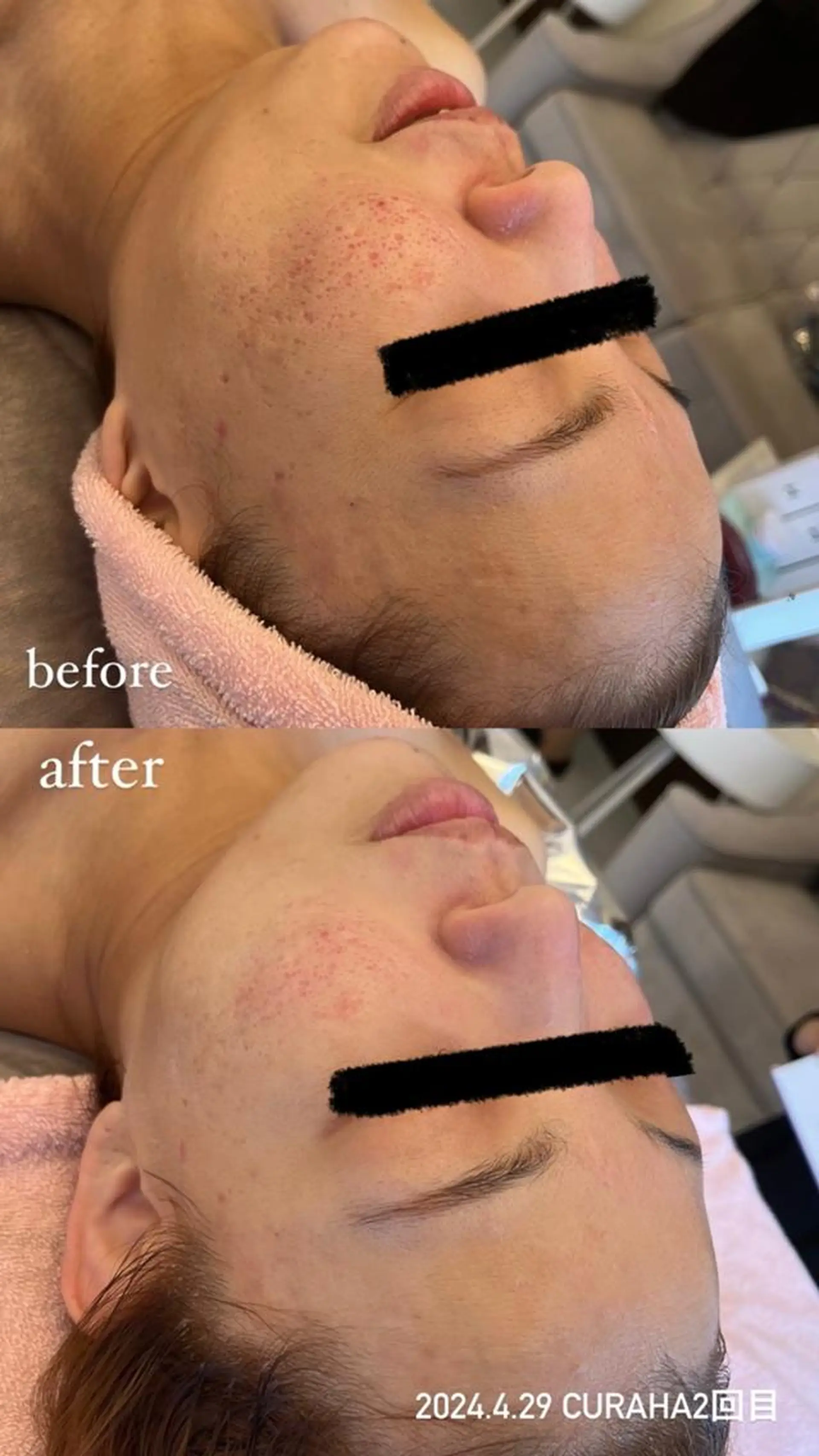 BLESS BEAUTYのエステ・リラクイメージ