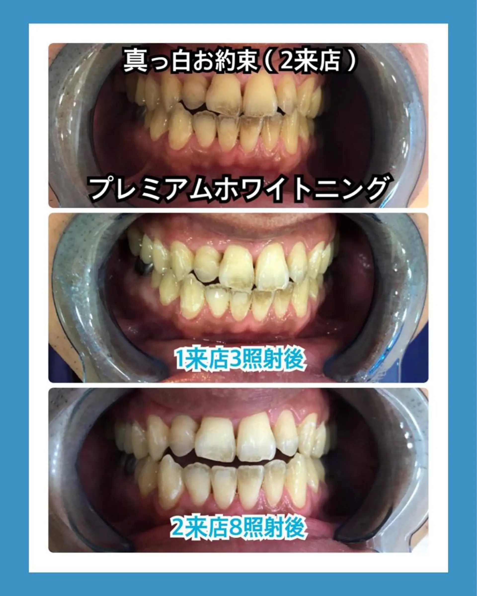 PLATINUM Beauty 横浜店所属・ホワイトニングルーム 横浜店のその他イメージ