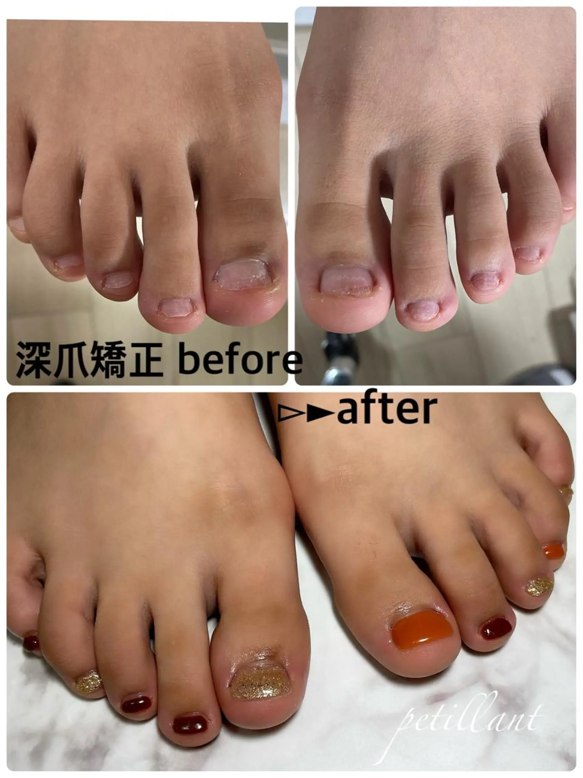 ネイル フットネイル ジェルネイル petillant所属・nail salon petillantのネイルデザイン