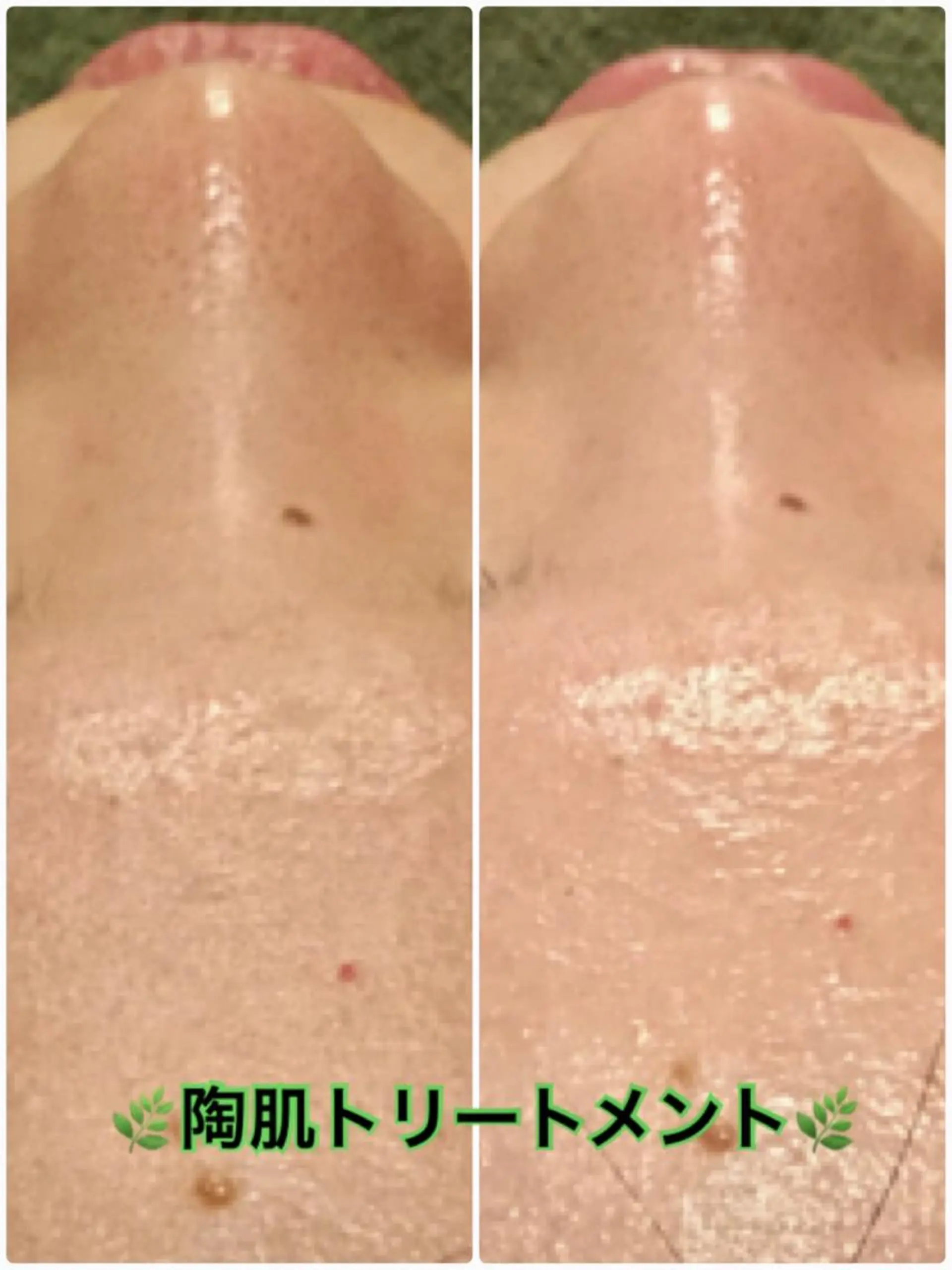 エステ 【リベルハーブピーリング認定店】敏感肌・美白脱毛専門店Dione立川店所属・Dione 立川店のエステ・リラクイメージ