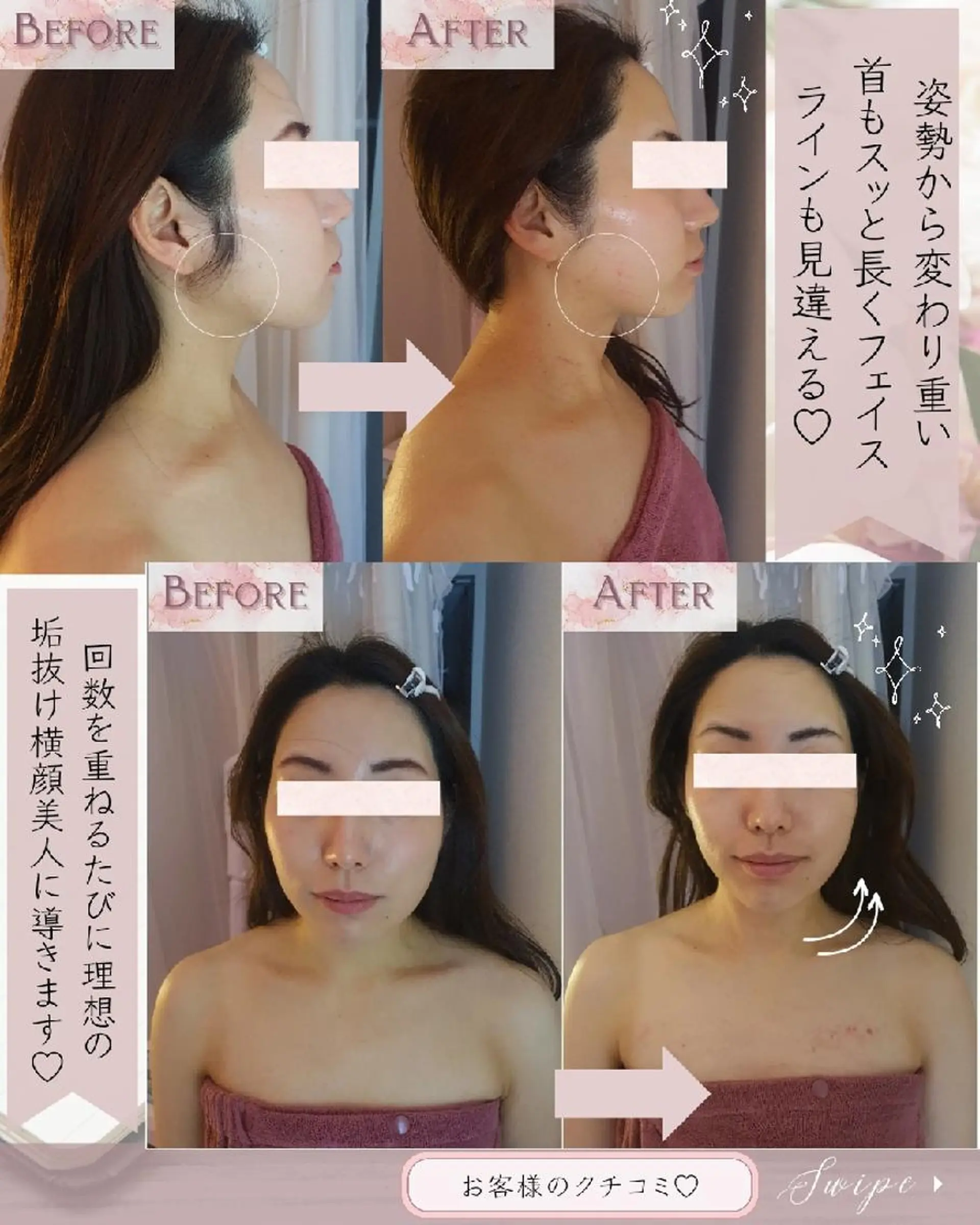 痩身ハーブピーリング 筋膜リリース☆B&Hのエステ・リラクイメージ