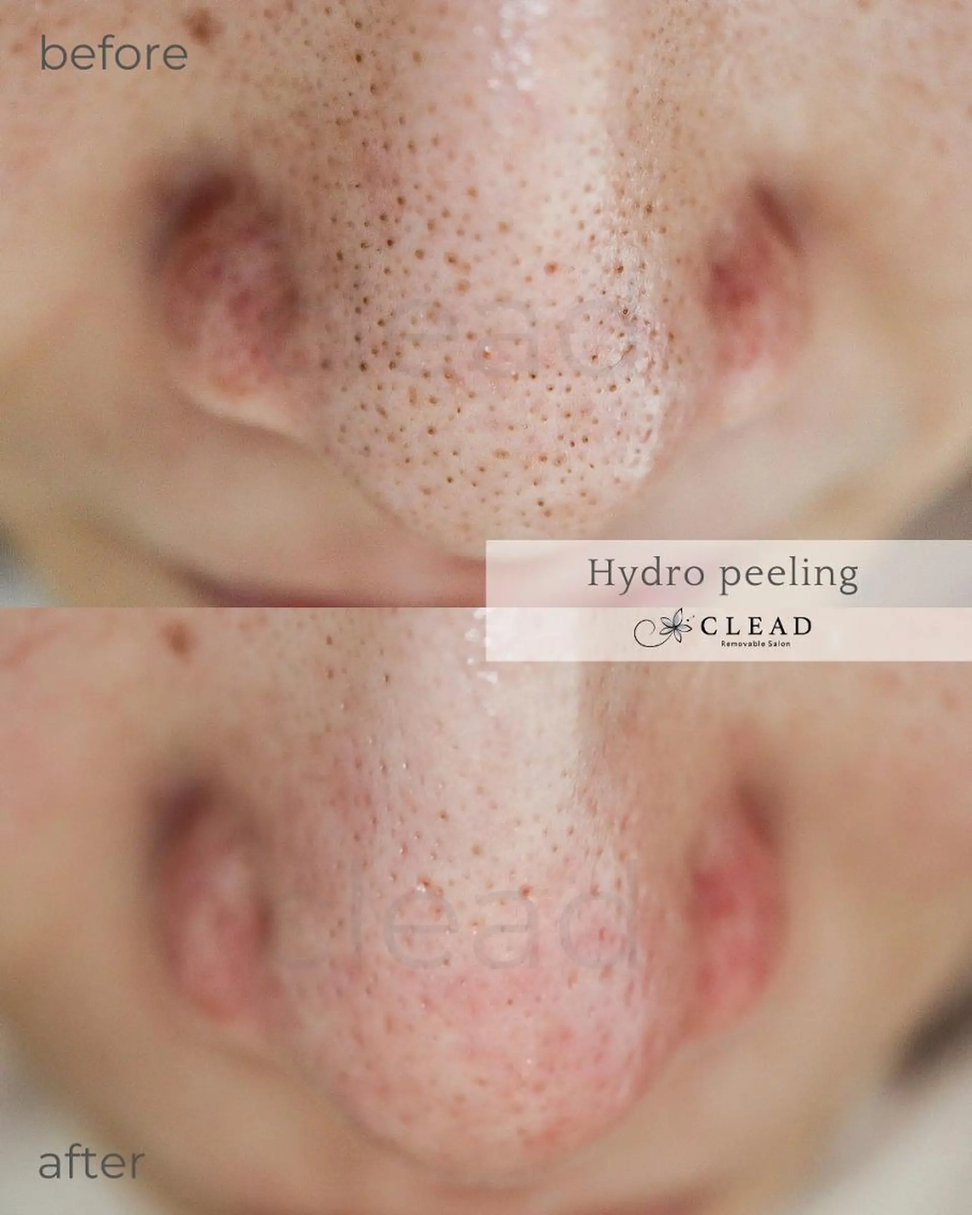 CLEAD 赤坂見附店のエステ・リラクイメージ