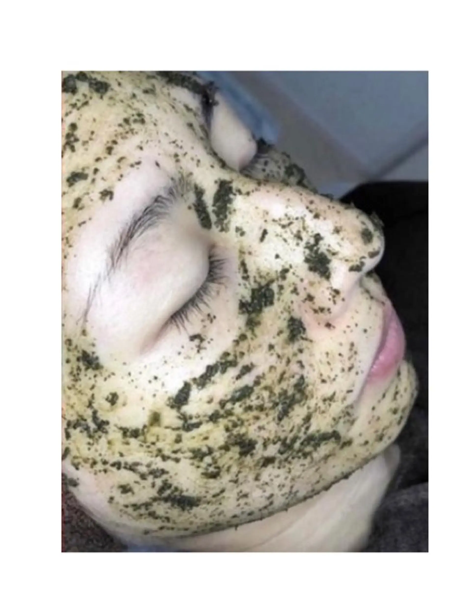 ハーブピーリング/韓国肌管理/フェイシャル/毛穴洗浄/眉毛/顔脱毛【糸脱毛専門】rev所属・ハーブピーリング🌹 毛穴洗浄❤️眉waxのエステ・リラクイメージ