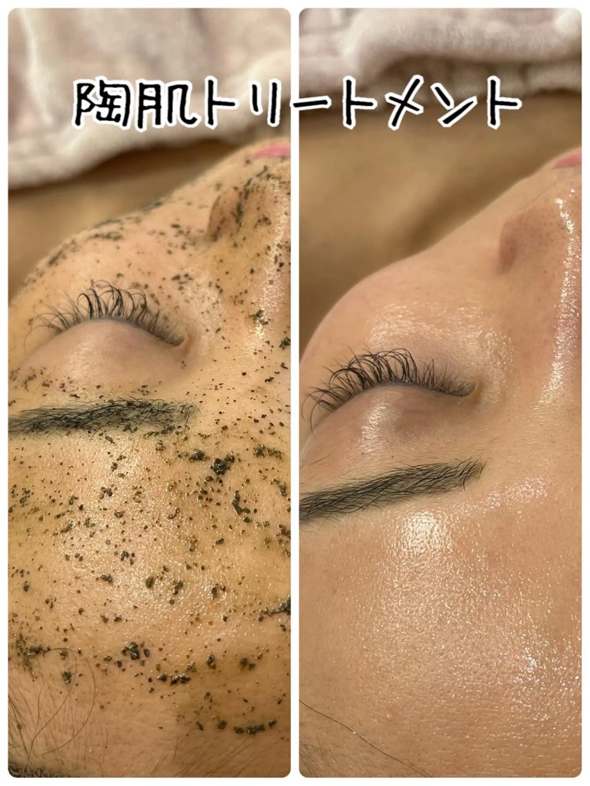 エステ Dione八王子店所属・LUKE （ルーク）のエステ・リラクイメージ