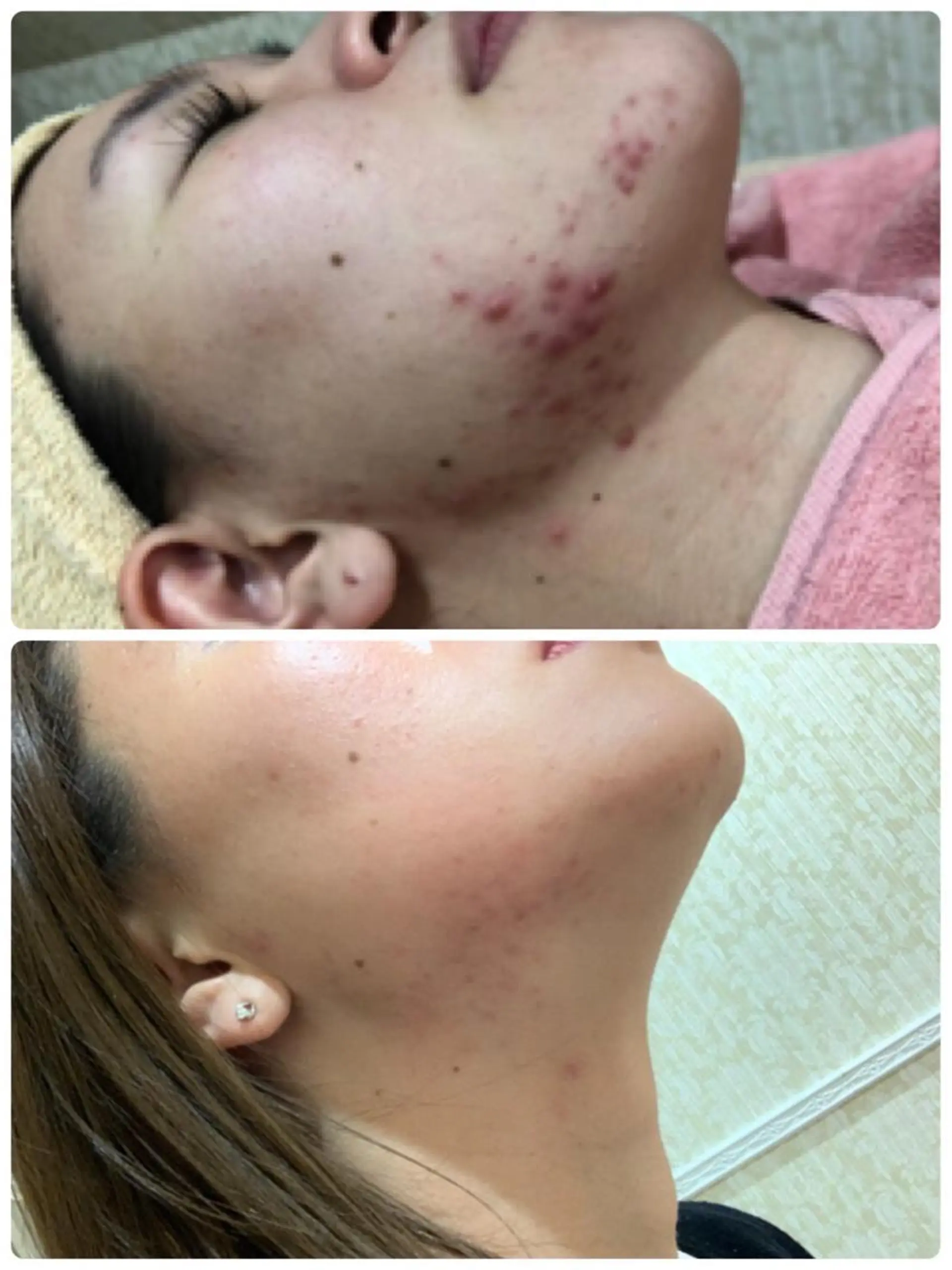 産後/ツヤ肌/子連れ /保育士在籍サロンのエステ・リラクイメージ