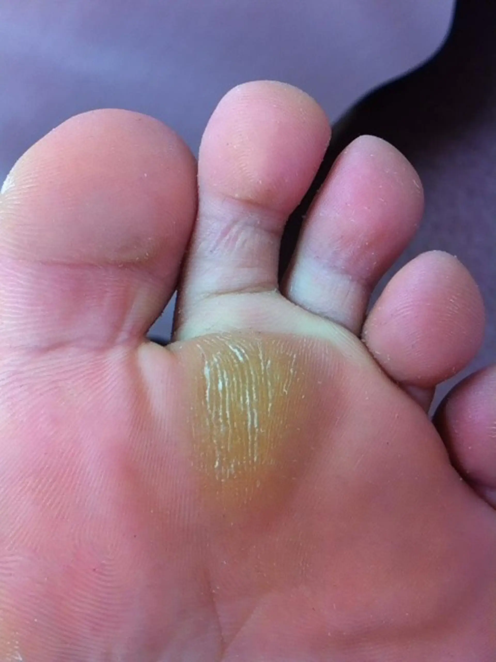 ネイル フットネイル その他(ネイル) 同心整骨院 美容鍼・整体・小顔のエステ・リラクイメージ