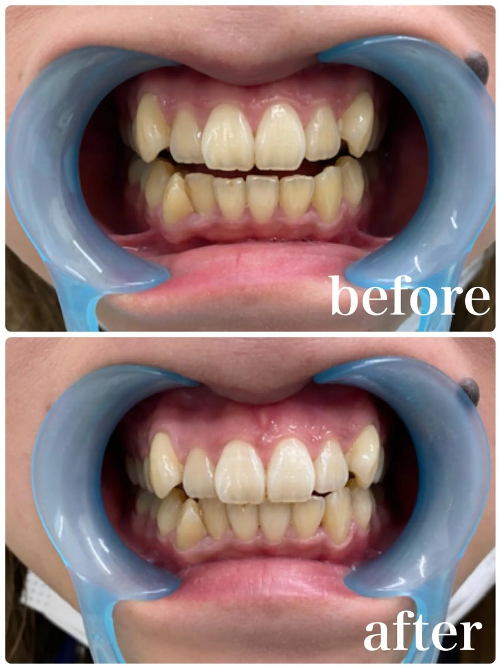 f.【エフドット】 二俣川のマツエク・マツパデザイン