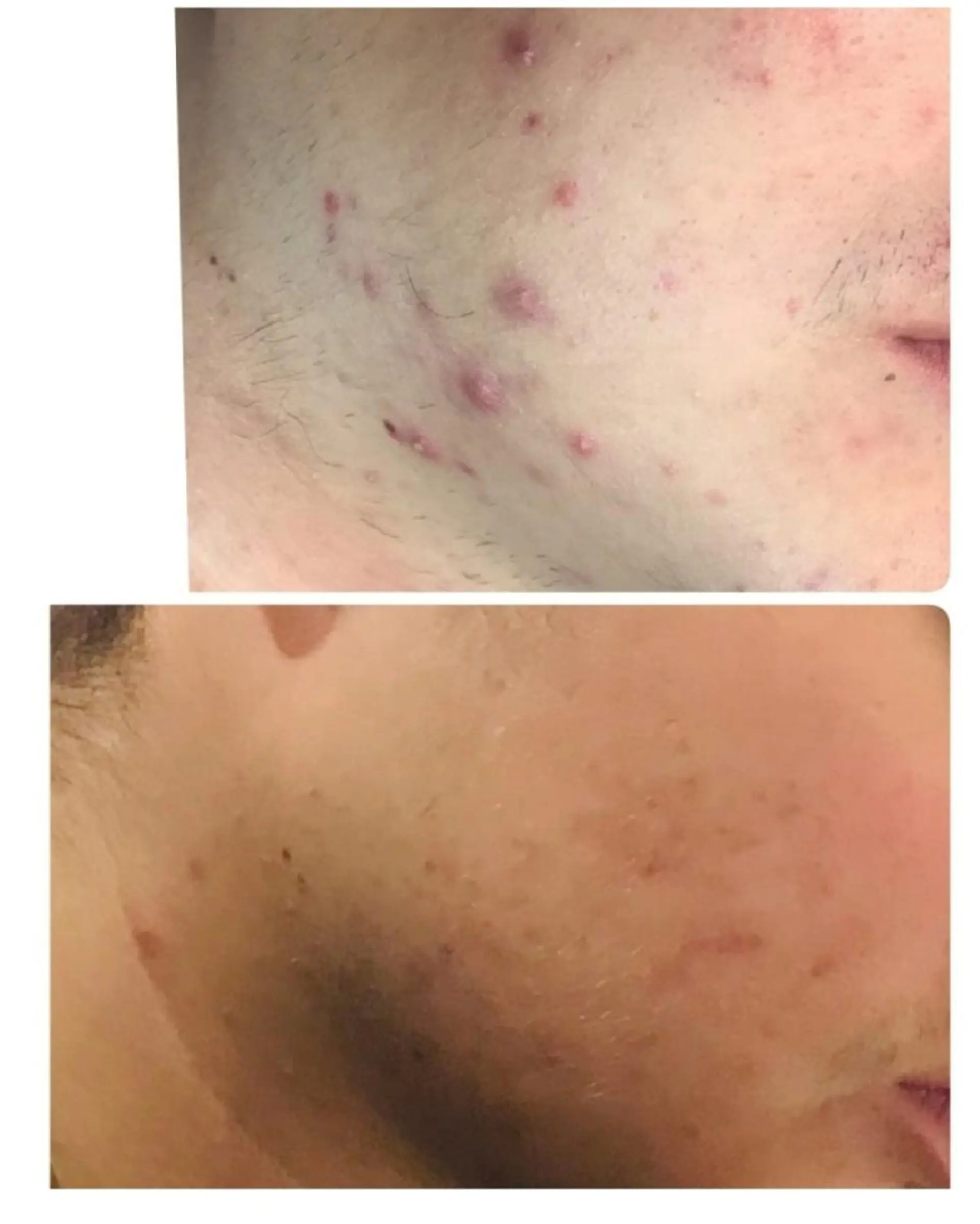 アロハーブ 韓国肌管理のエステ・リラクイメージ