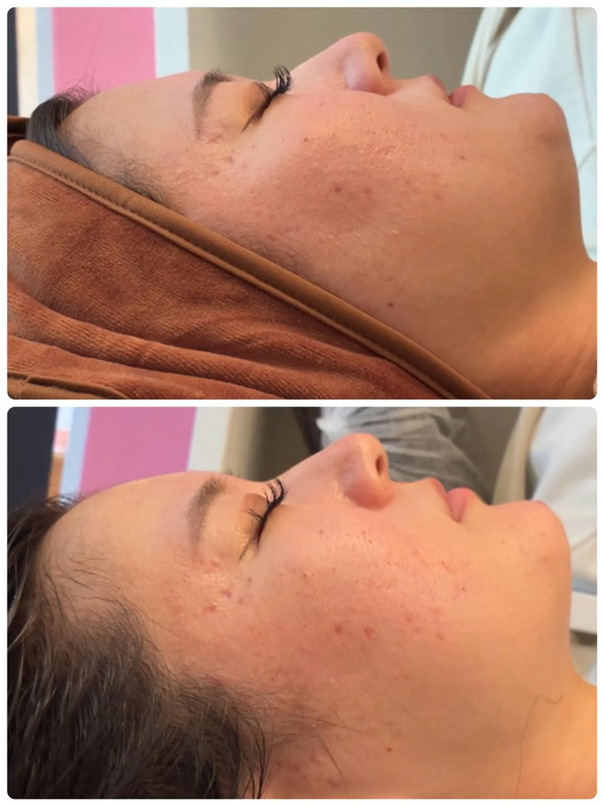 FLEUR🫧 フェイシャルのエステ・リラクイメージ