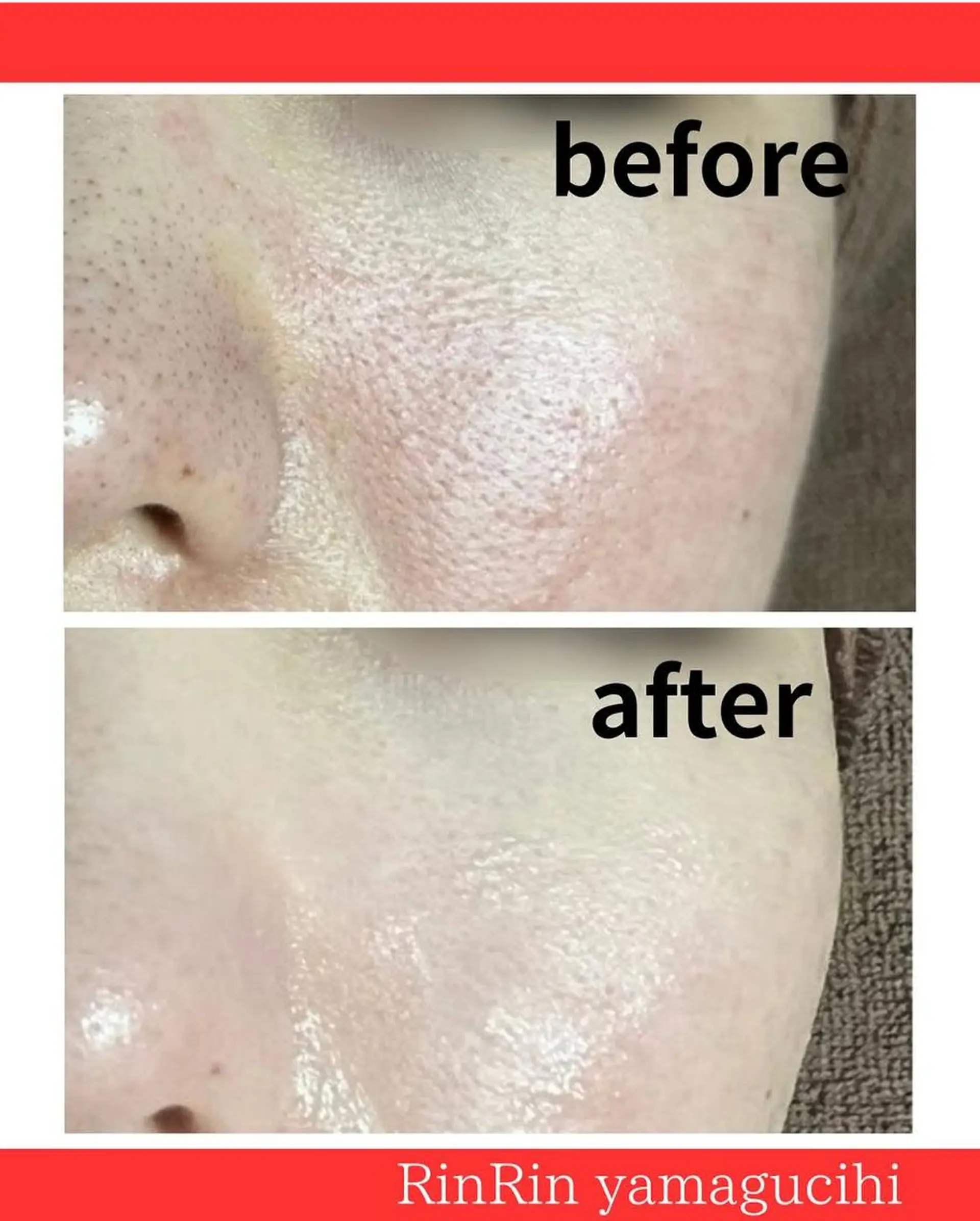 その他 RinRin 山口店のエステ・リラクイメージ